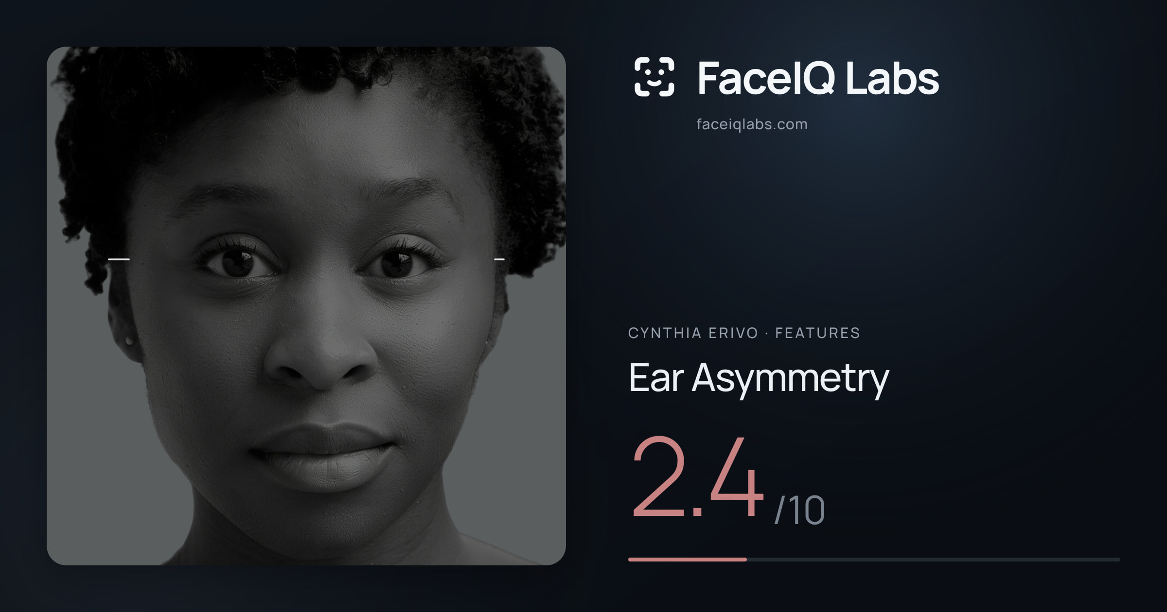 Cynthia Erivo Ear Asymmetry: 2.4/10, drawn on the photo