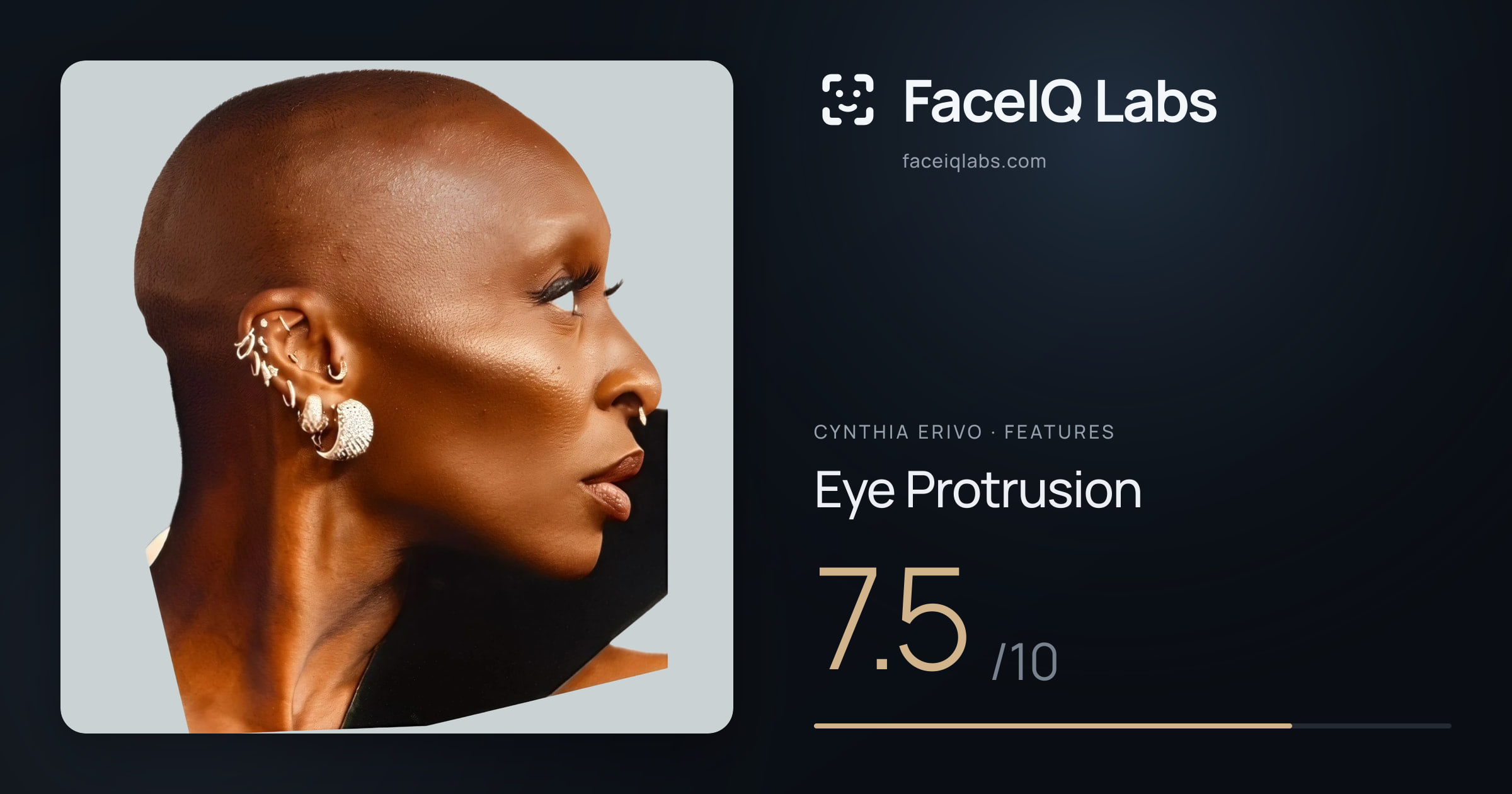 Cynthia Erivo Eye Protrusion: 7.5/10, drawn on the photo