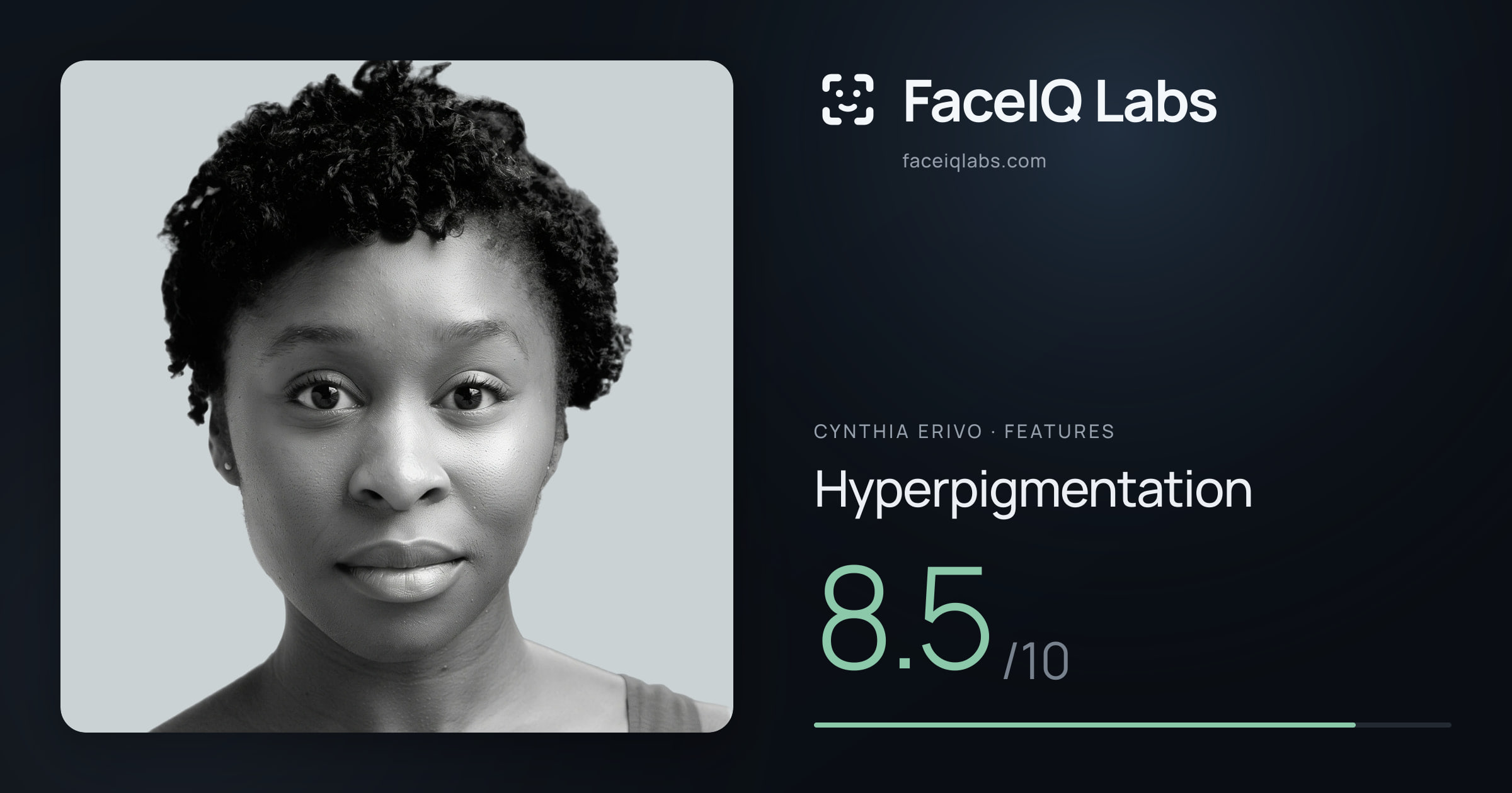 Cynthia Erivo Hyperpigmentation: 8.5/10, drawn on the photo