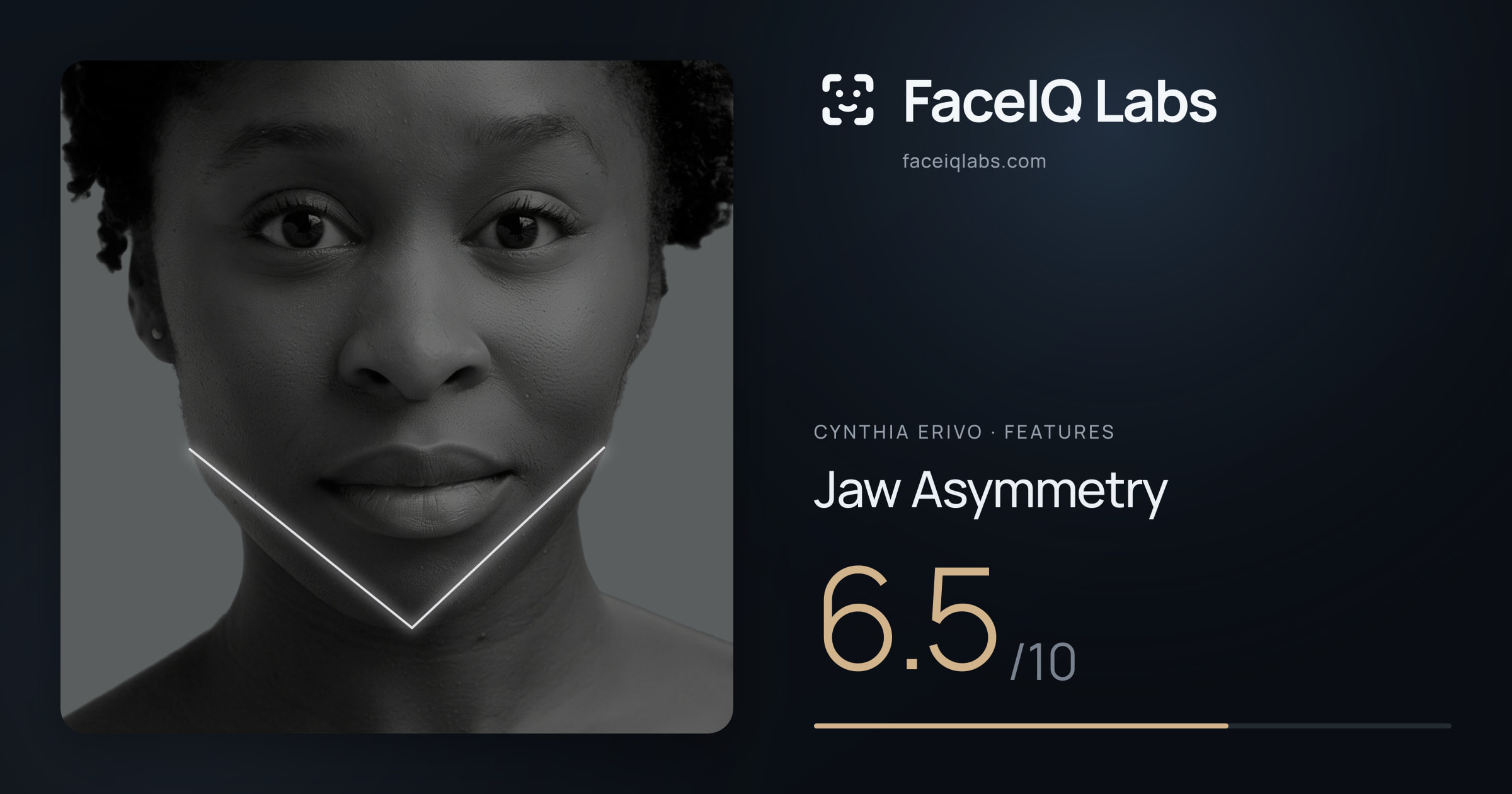 Cynthia Erivo Jaw Asymmetry: 6.5/10, drawn on the photo