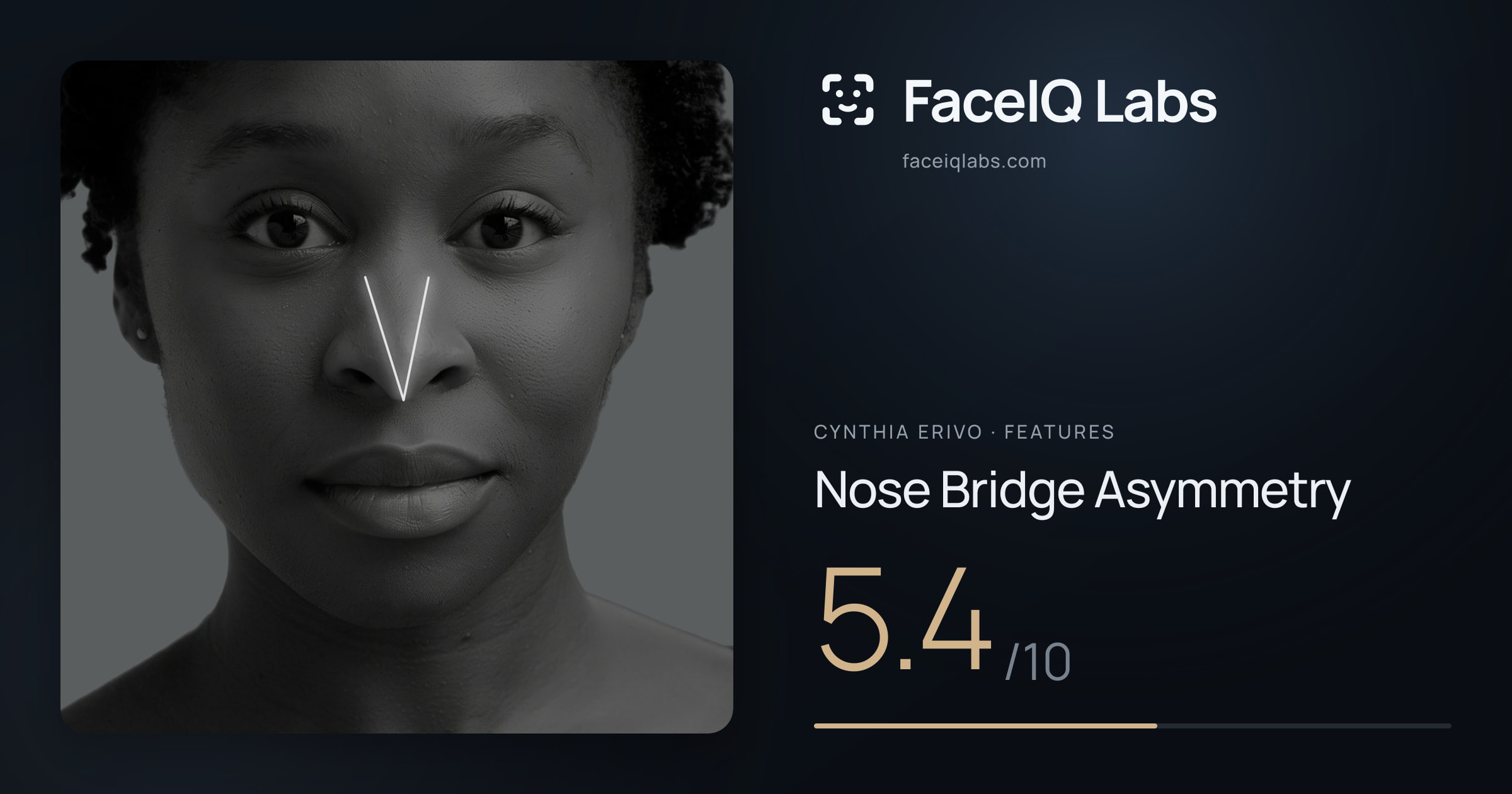 Cynthia Erivo Nose Bridge Asymmetry: 5.4/10, drawn on the photo