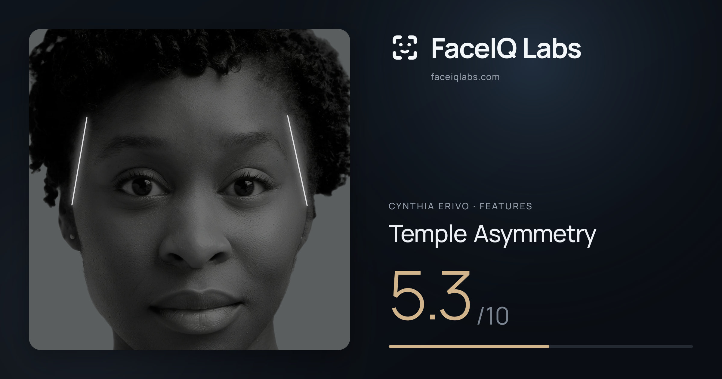 Cynthia Erivo Temple Asymmetry: 5.3/10, drawn on the photo