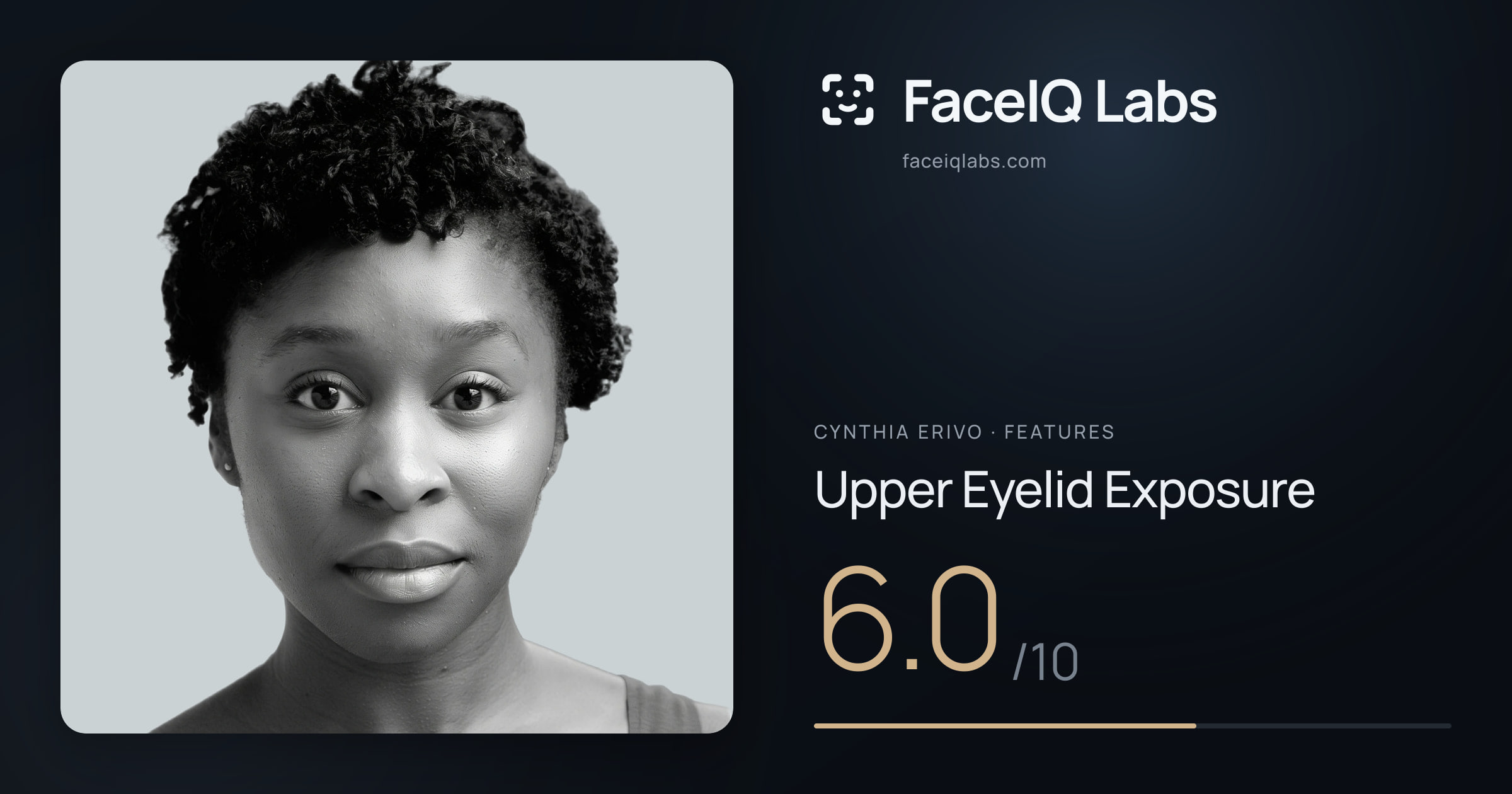 Cynthia Erivo Upper Eyelid Exposure: 6.0/10, drawn on the photo