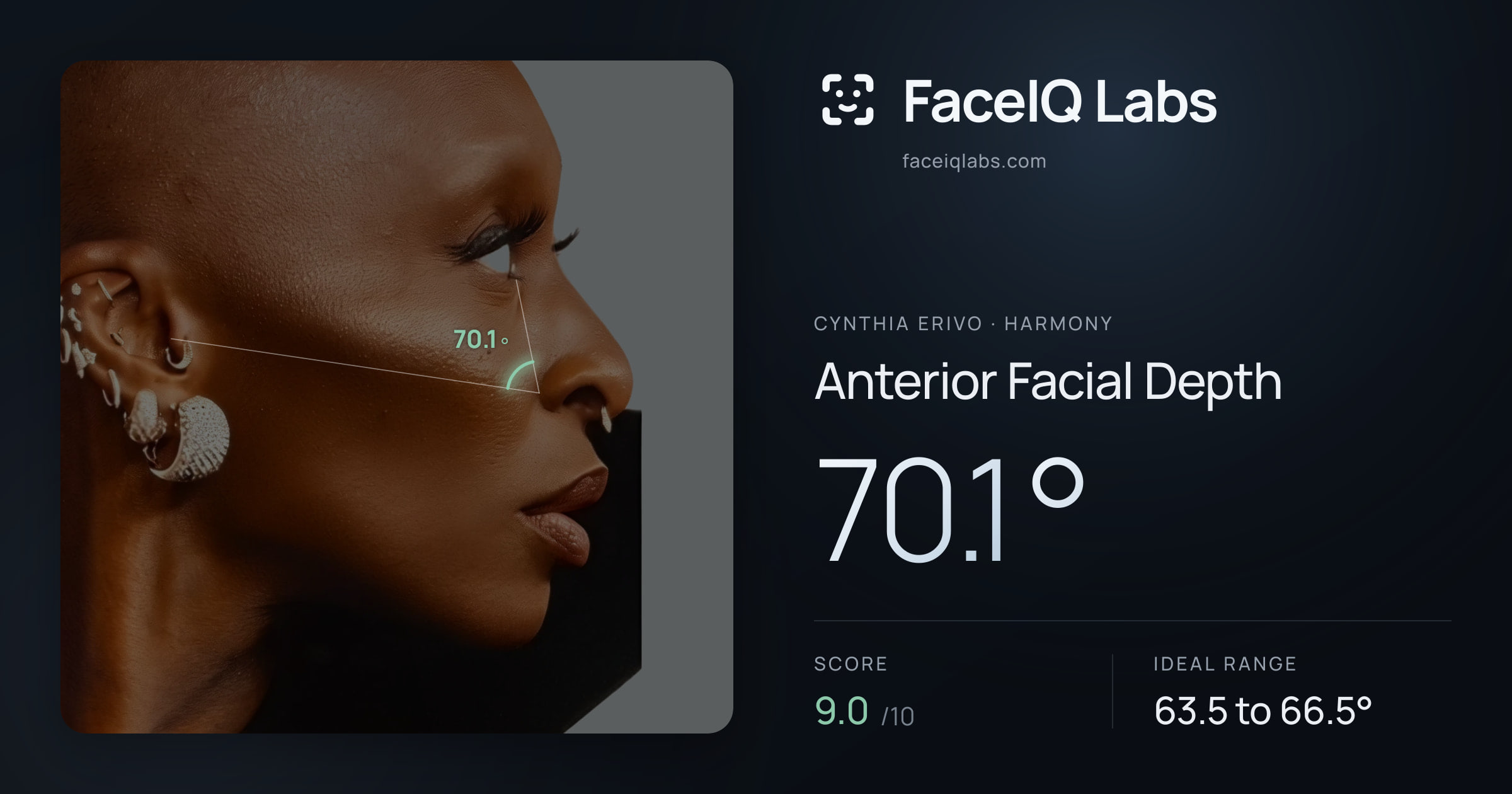 Cynthia Erivo Anterior Facial Depth: 70.1°, drawn on the photo