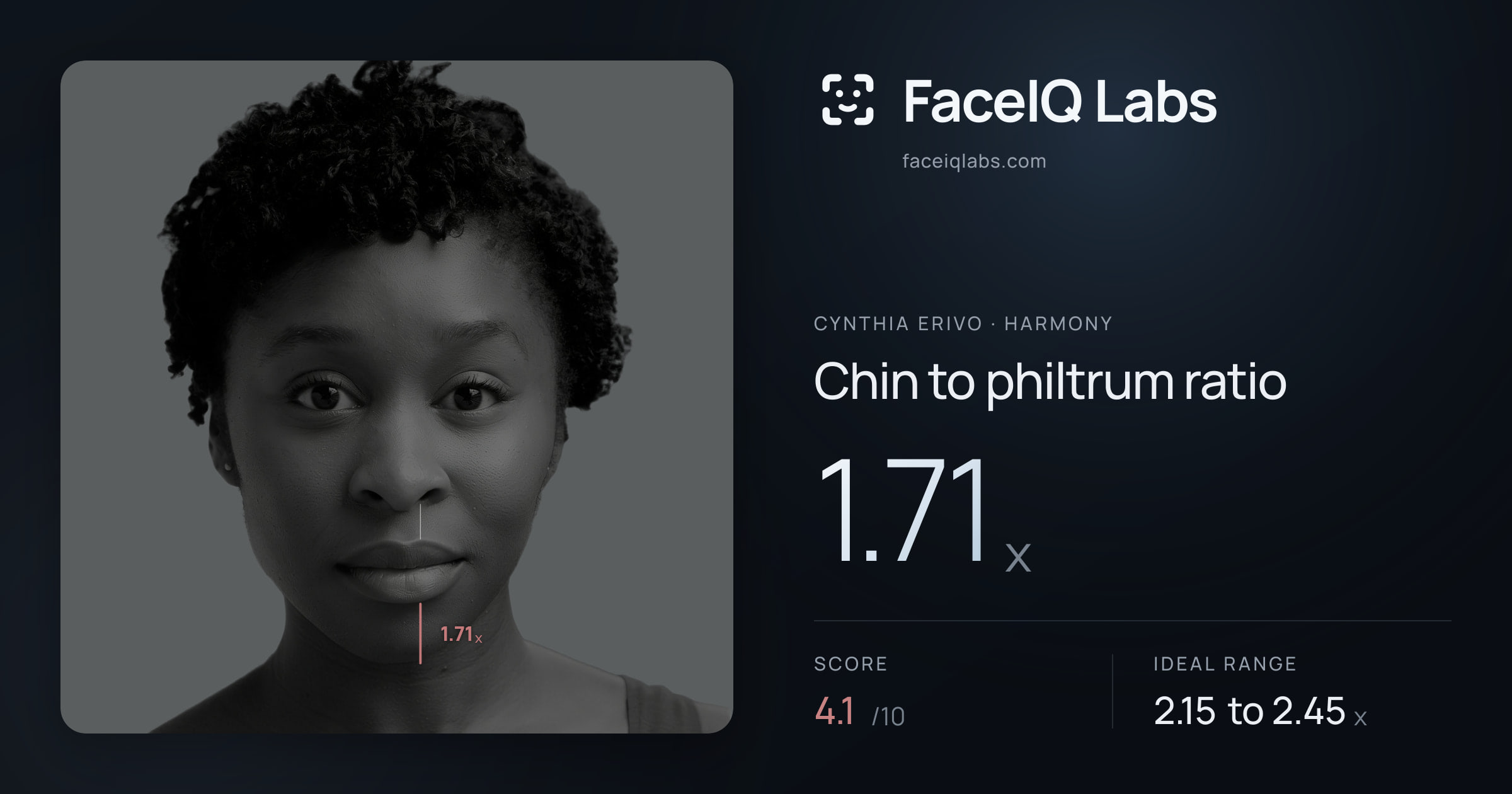 Cynthia Erivo Chin to philtrum ratio: 1.71x, drawn on the photo