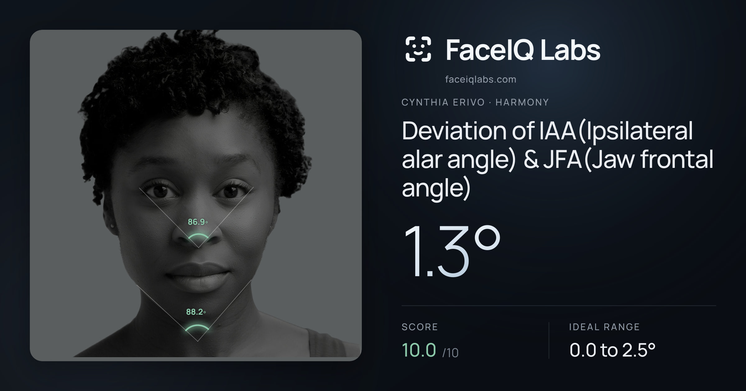 Cynthia Erivo Deviation of IAA(Ipsilateral alar angle) & JFA(Jaw frontal angle): 1.3°, drawn on the photo