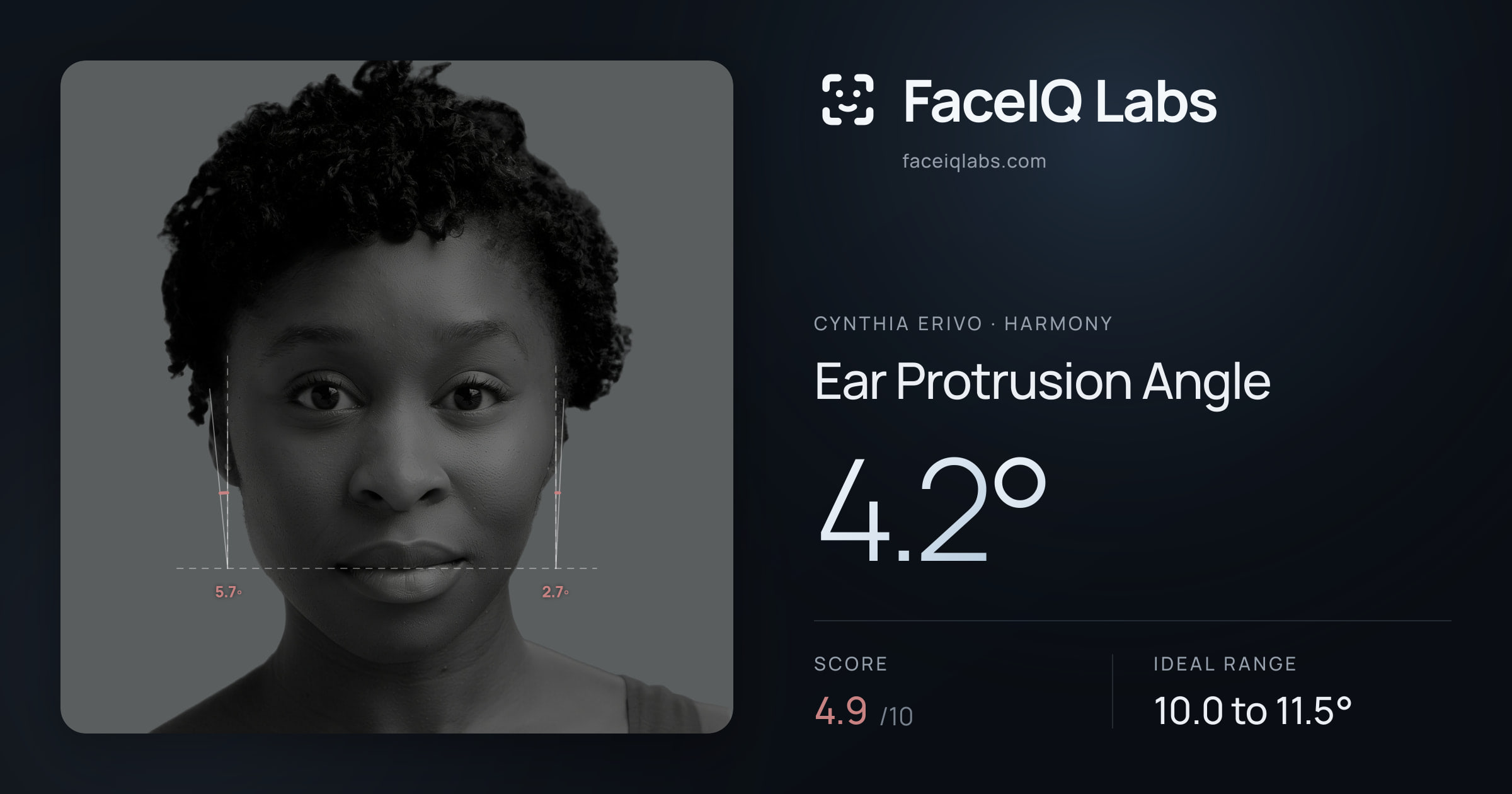 Cynthia Erivo Ear Protrusion Angle: 4.2°, drawn on the photo