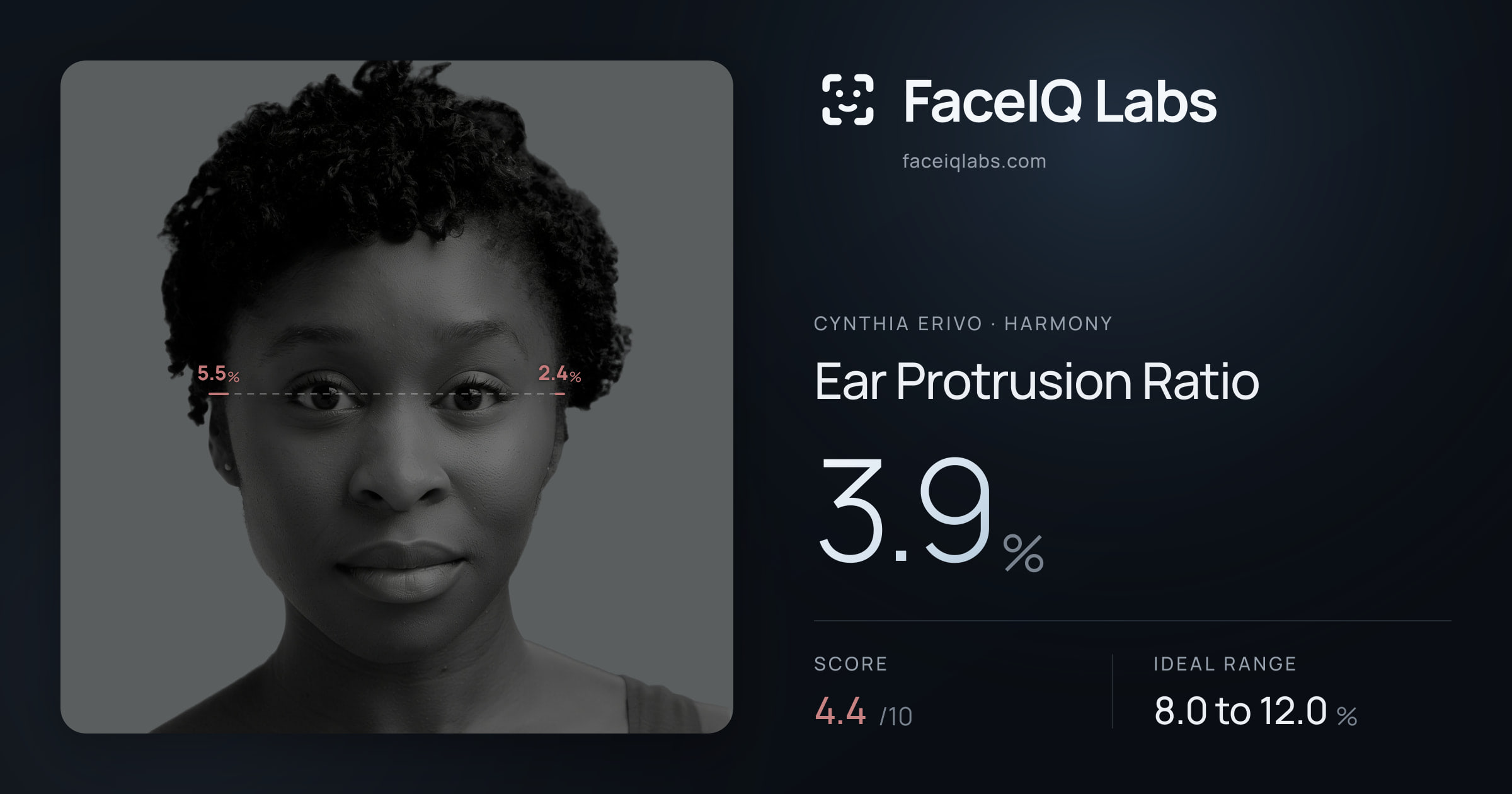 Cynthia Erivo Ear Protrusion Ratio: 3.9%, drawn on the photo