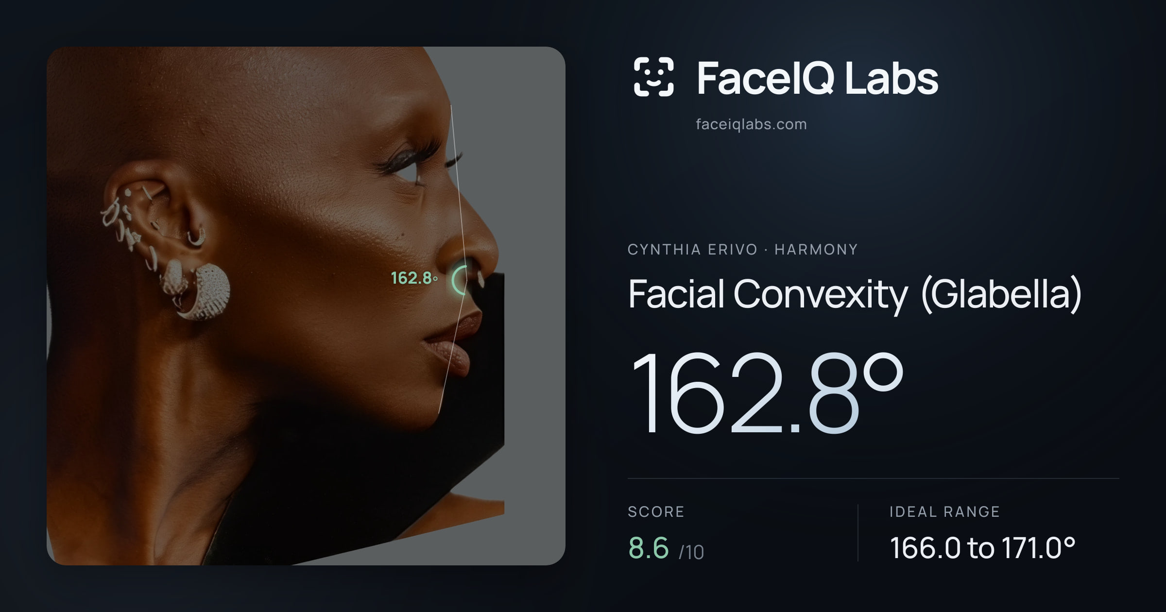 Cynthia Erivo Facial Convexity (Glabella): 162.8°, drawn on the photo