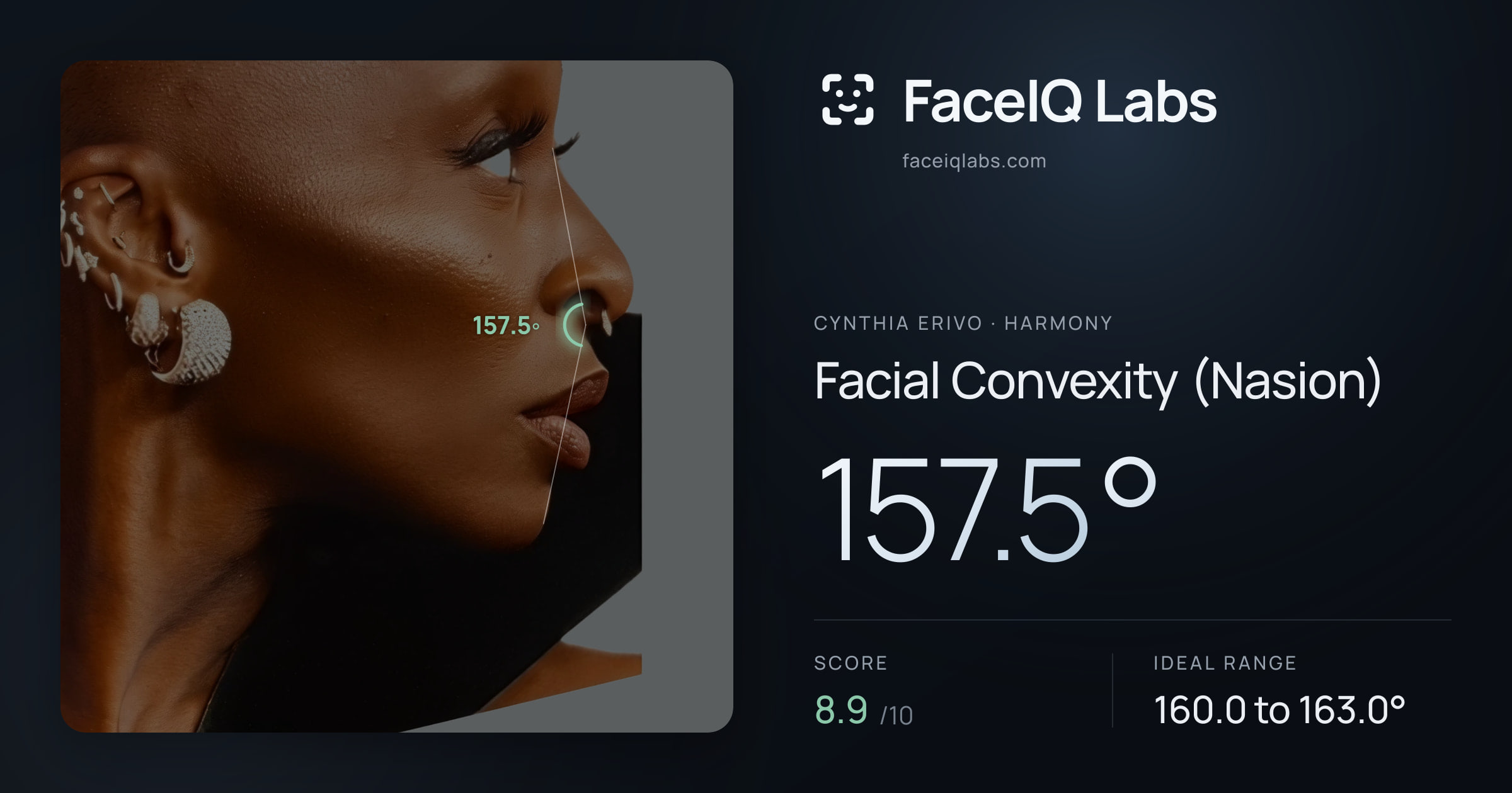 Cynthia Erivo Facial Convexity (Nasion): 157.5°, drawn on the photo