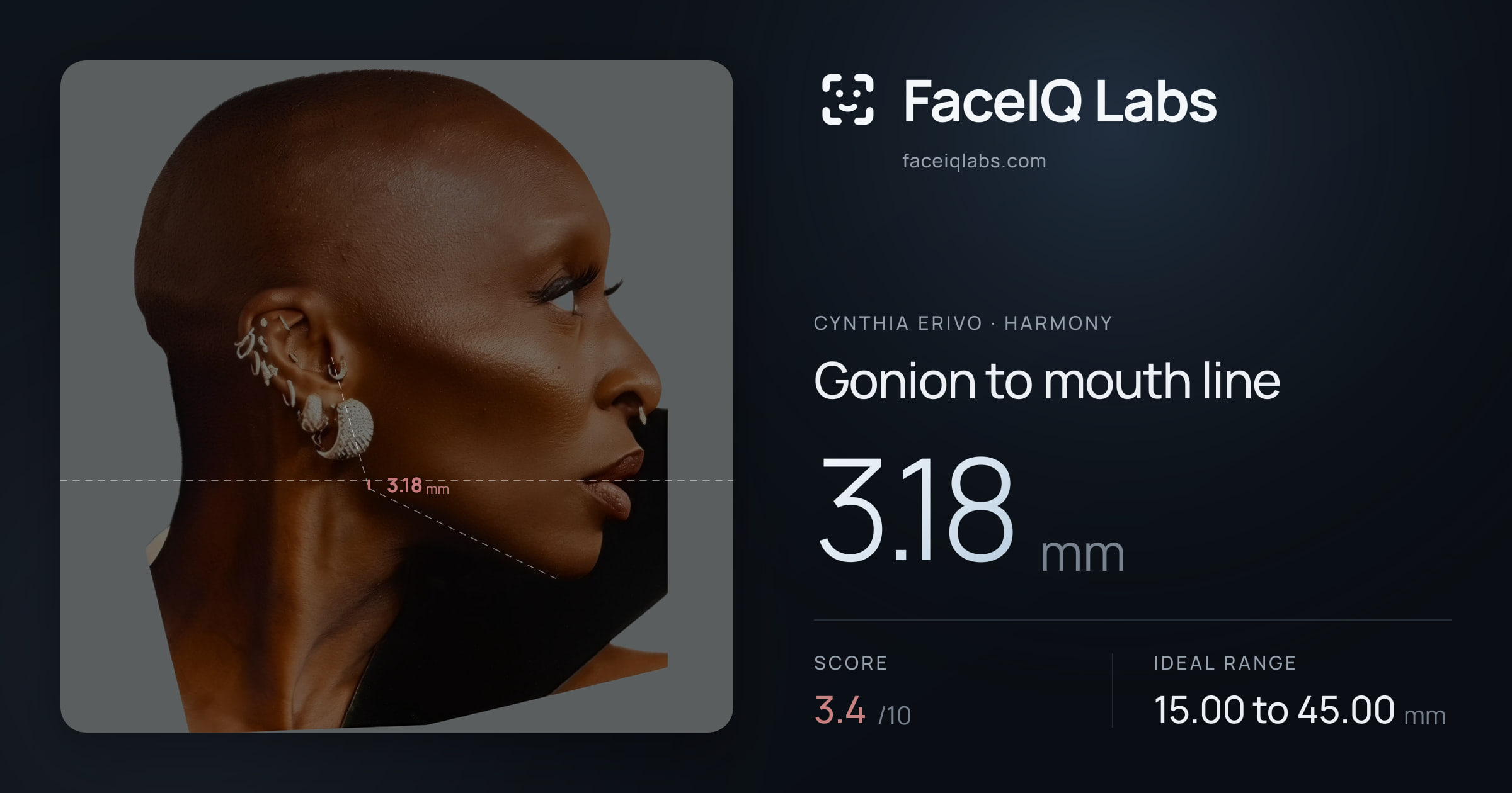 Cynthia Erivo Gonion to mouth line: 3.18mm, drawn on the photo