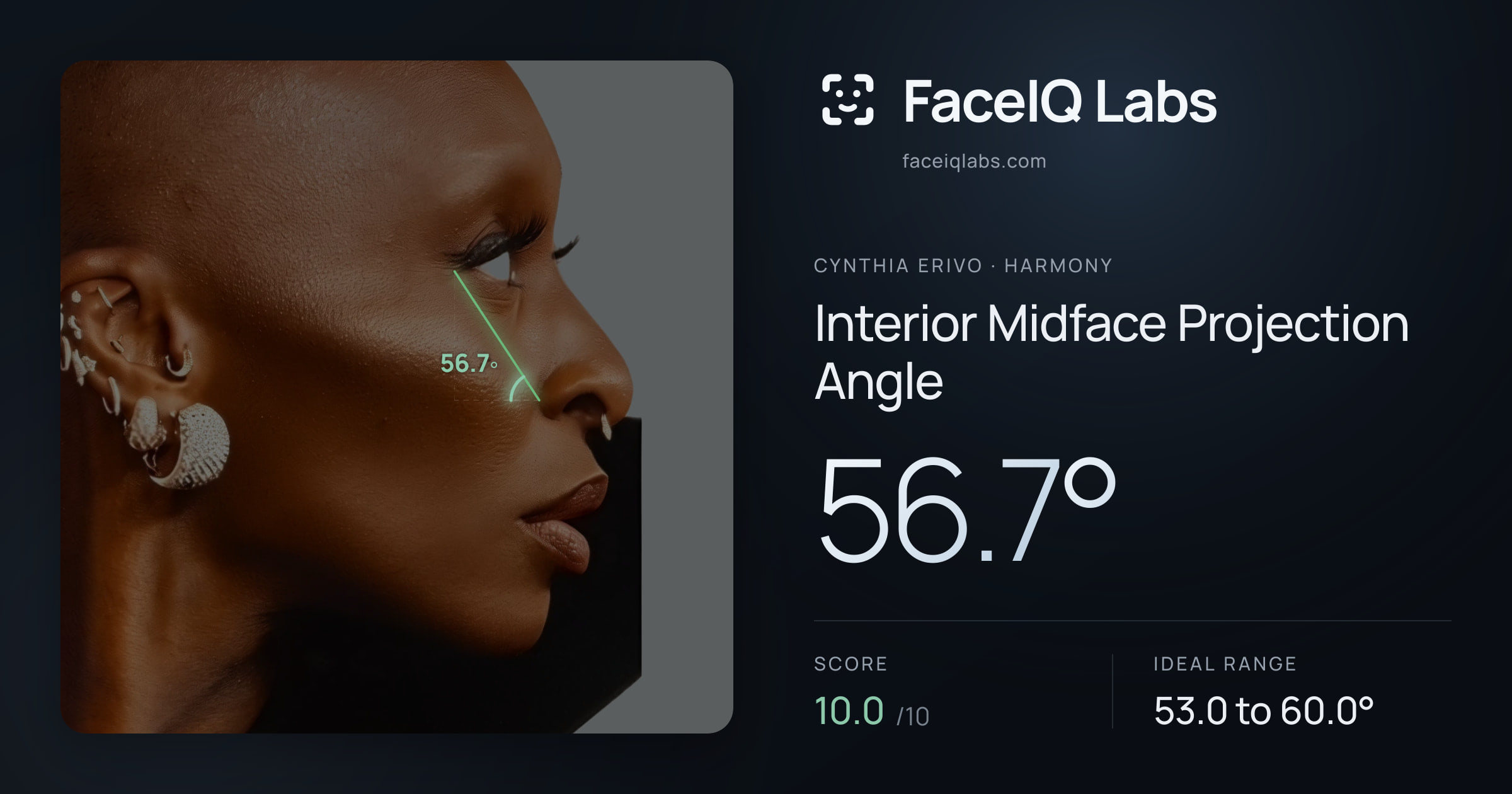 Cynthia Erivo Interior Midface Projection Angle: 56.7°, drawn on the photo
