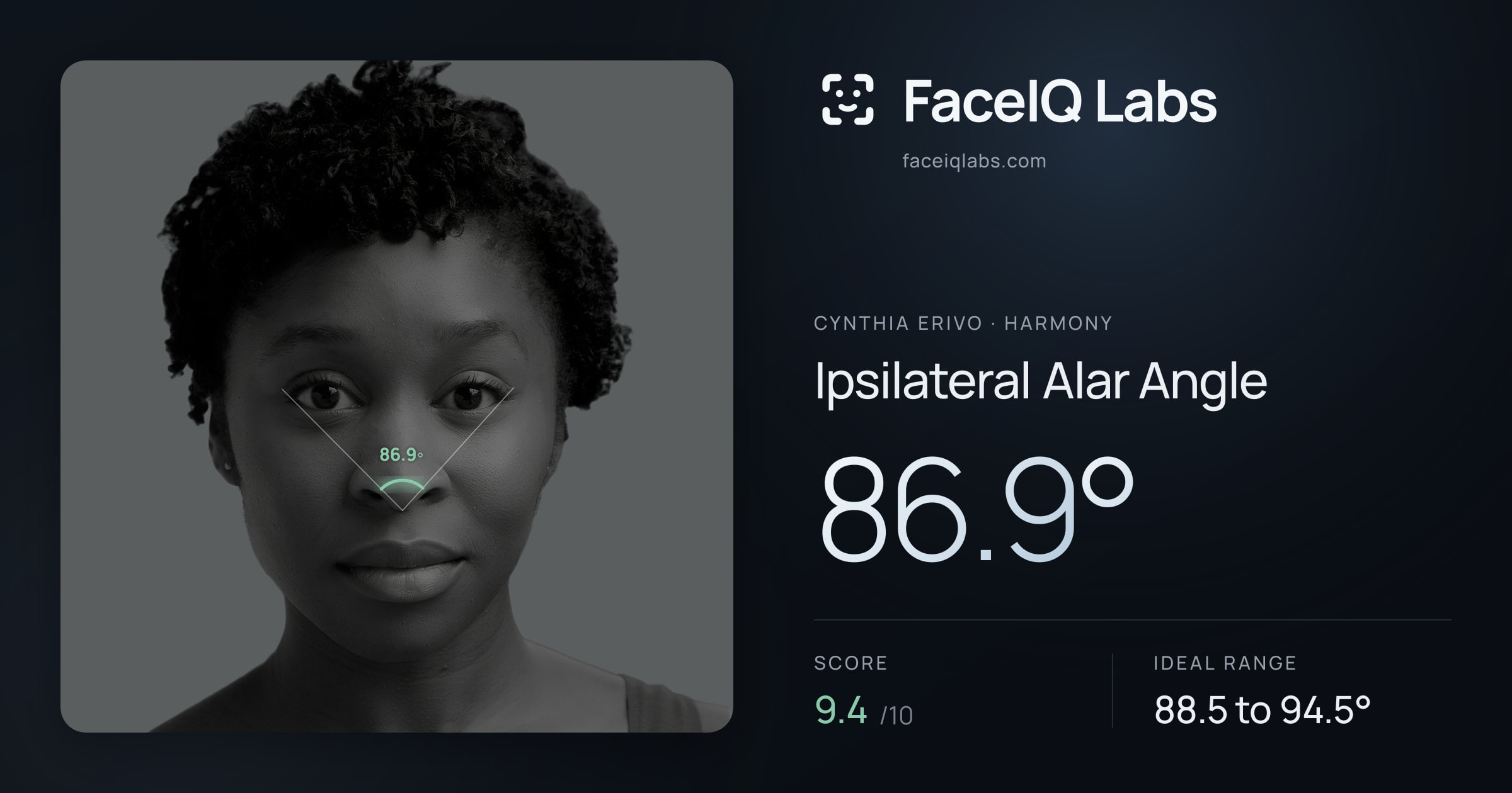 Cynthia Erivo Ipsilateral Alar Angle: 86.9°, drawn on the photo