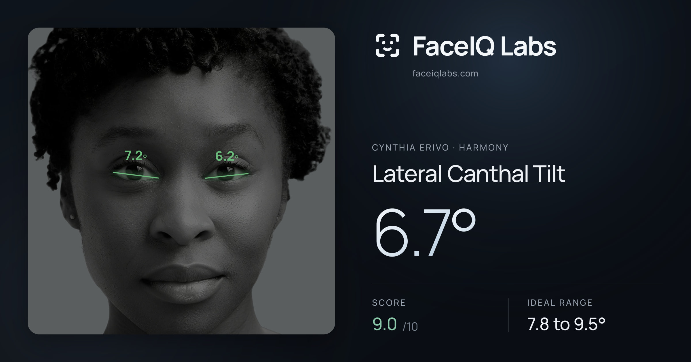 Cynthia Erivo Lateral Canthal Tilt: 6.7°, drawn on the photo