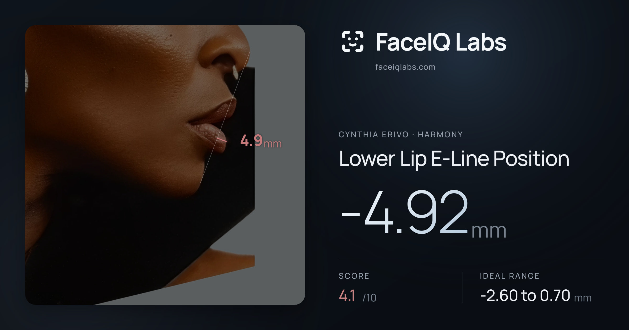 Cynthia Erivo Lower Lip E-Line Position: -4.92mm, drawn on the photo