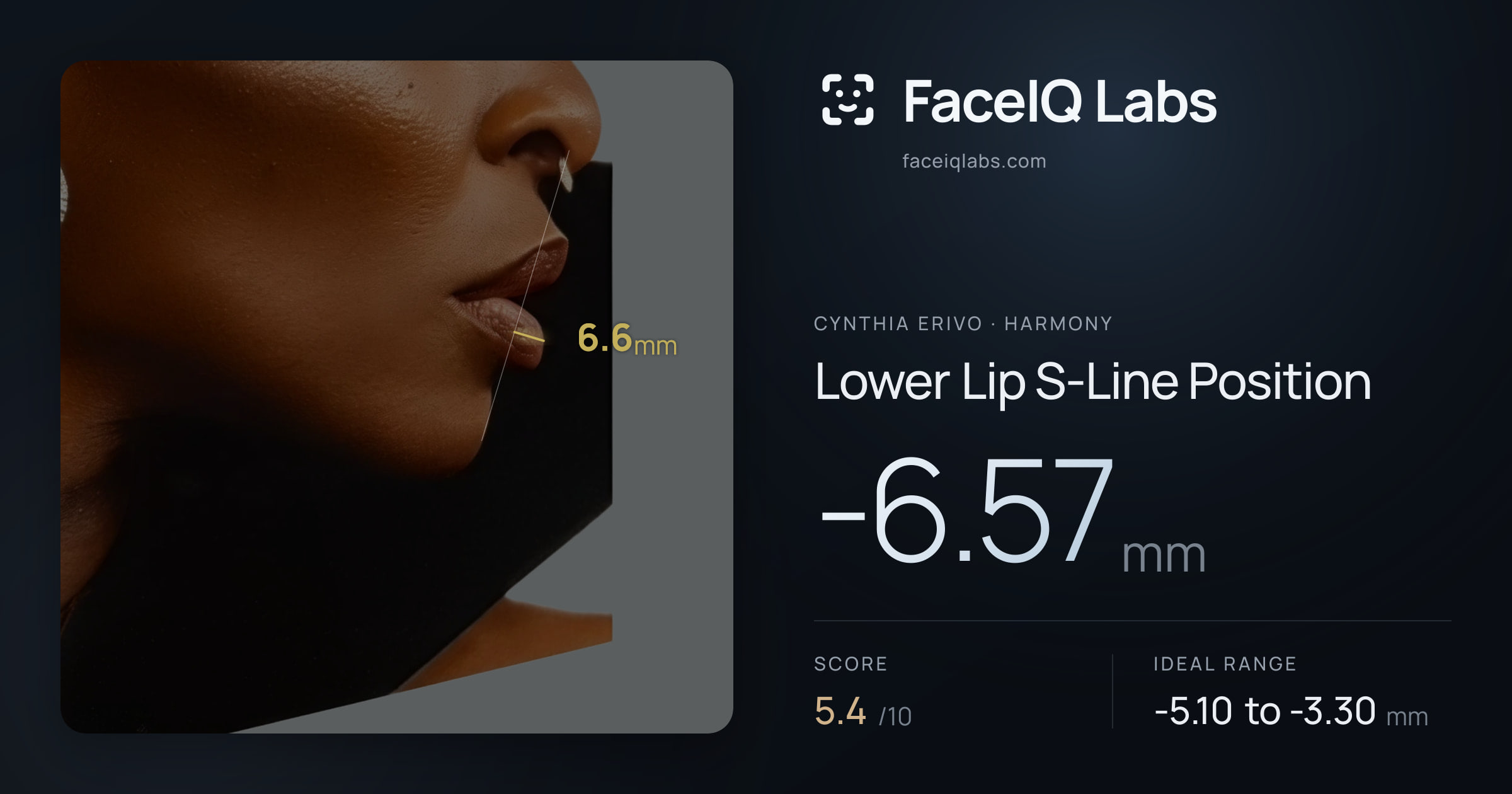 Cynthia Erivo Lower Lip S-Line Position: -6.57mm, drawn on the photo