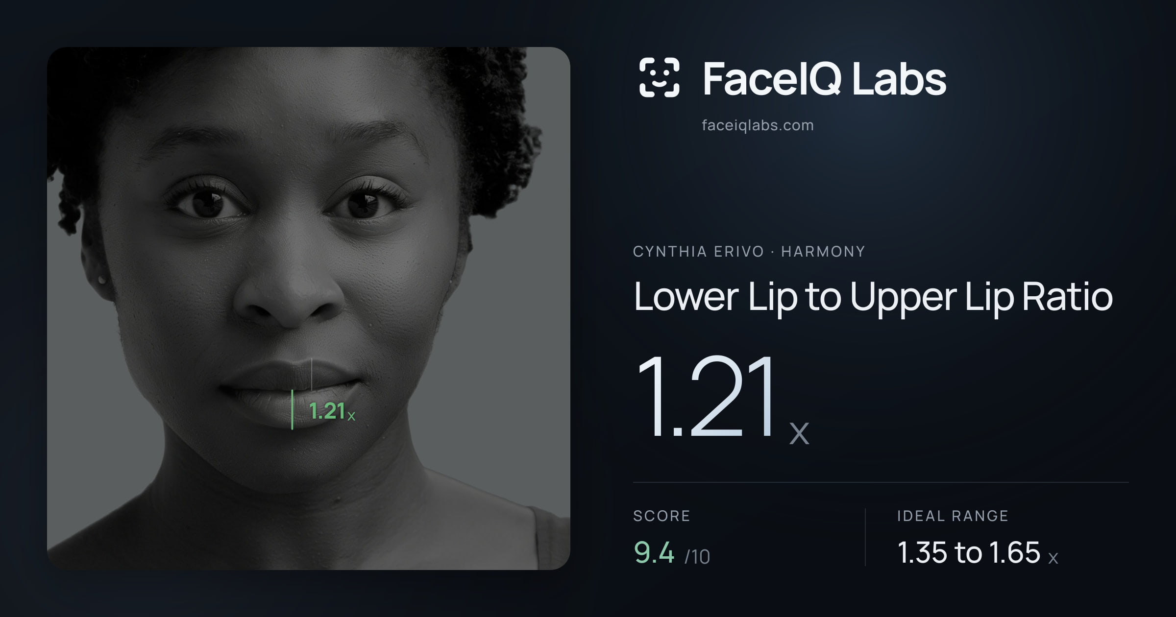 Cynthia Erivo Lower Lip to Upper Lip Ratio: 1.21x, drawn on the photo