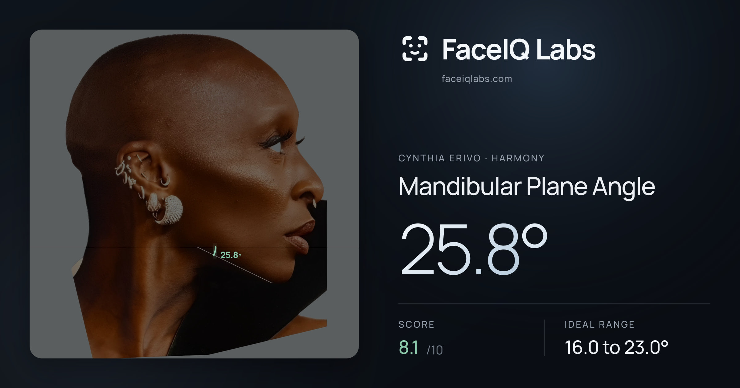 Cynthia Erivo Mandibular Plane Angle: 25.8°, drawn on the photo
