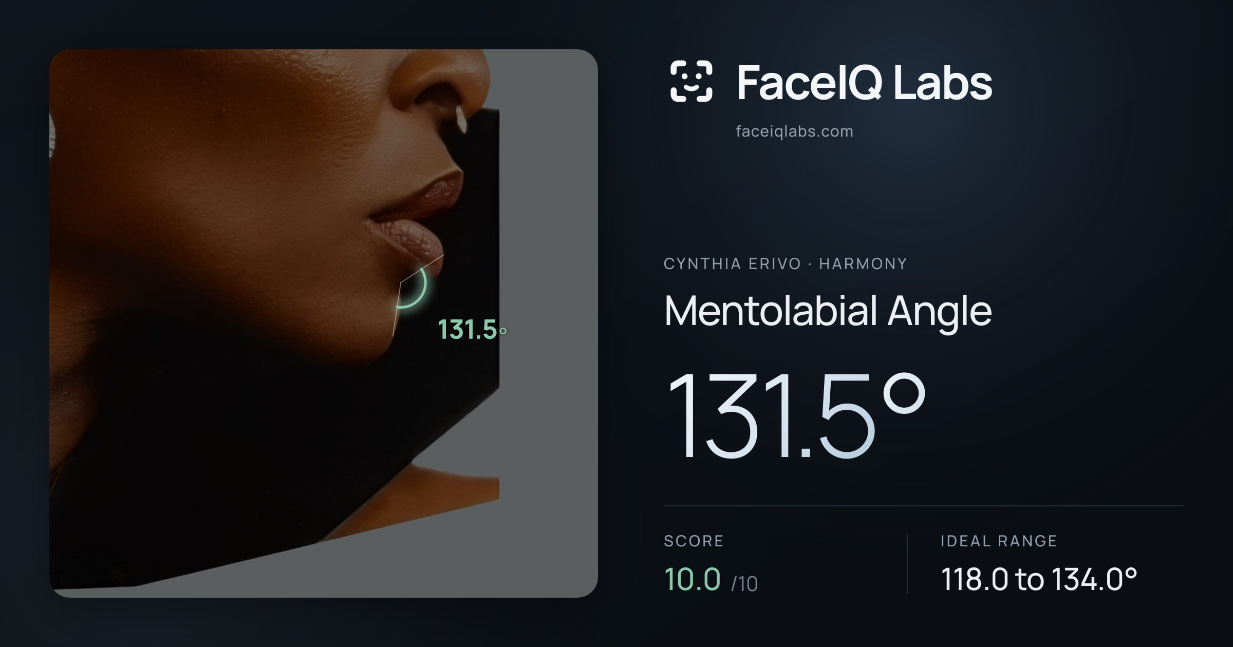 Cynthia Erivo Mentolabial Angle: 131.5°, drawn on the photo
