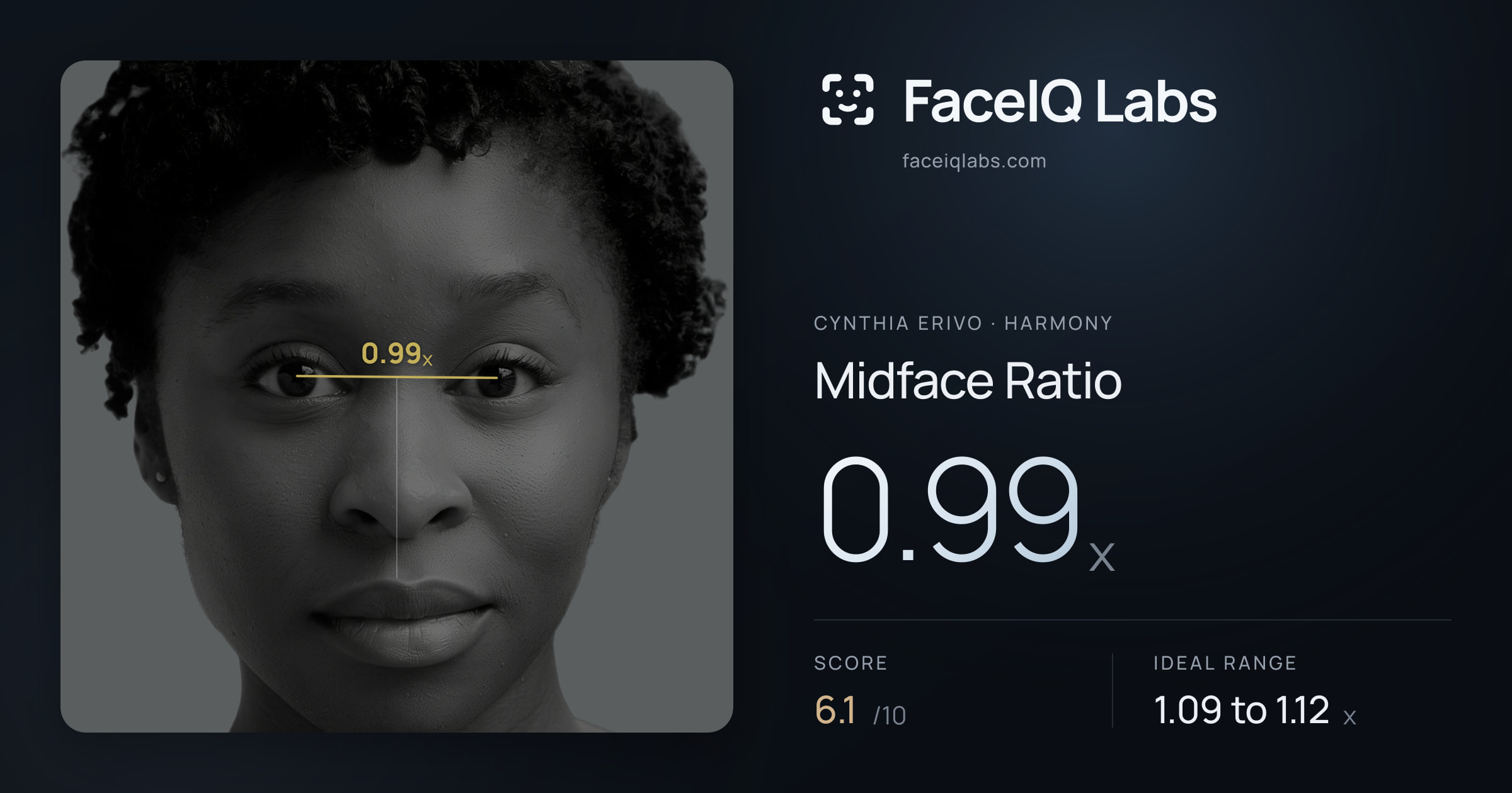 Cynthia Erivo Midface Ratio: 0.99x, drawn on the photo