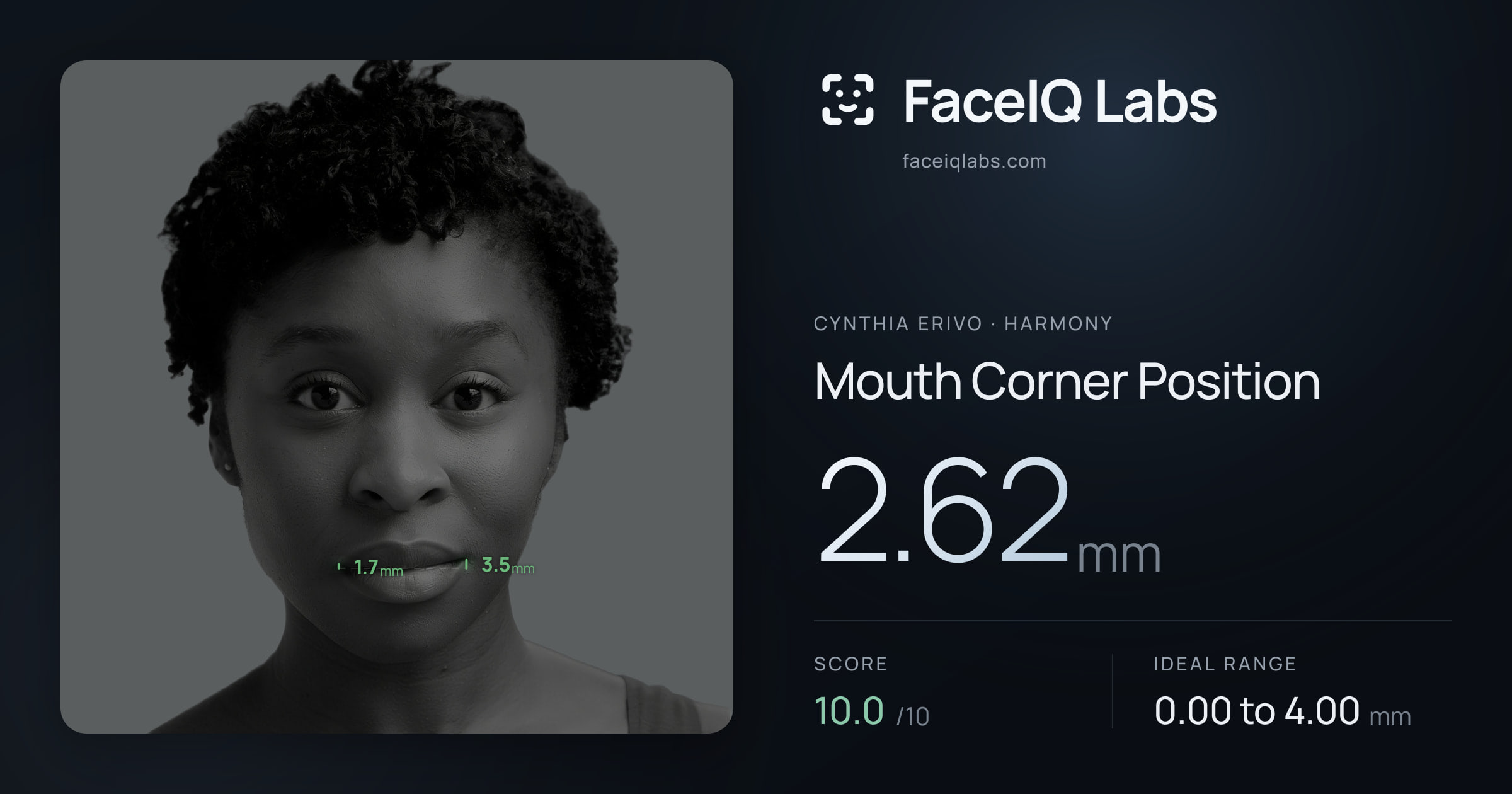 Cynthia Erivo Mouth Corner Position: 2.62mm, drawn on the photo