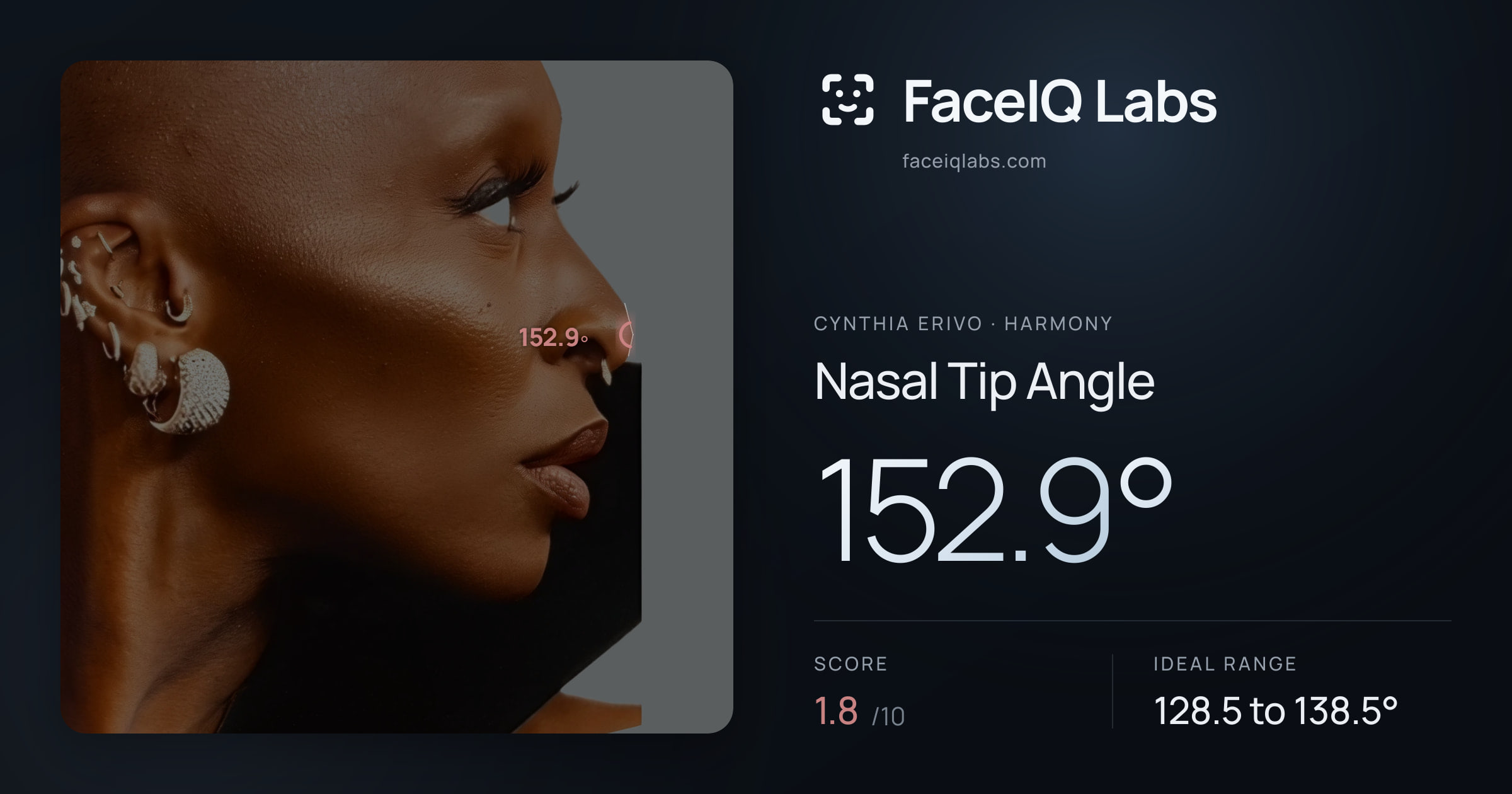 Cynthia Erivo Nasal Tip Angle: 152.9°, drawn on the photo
