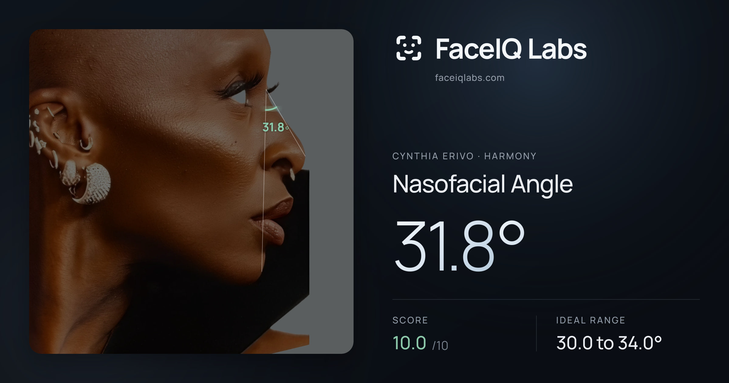 Cynthia Erivo Nasofacial Angle: 31.8°, drawn on the photo