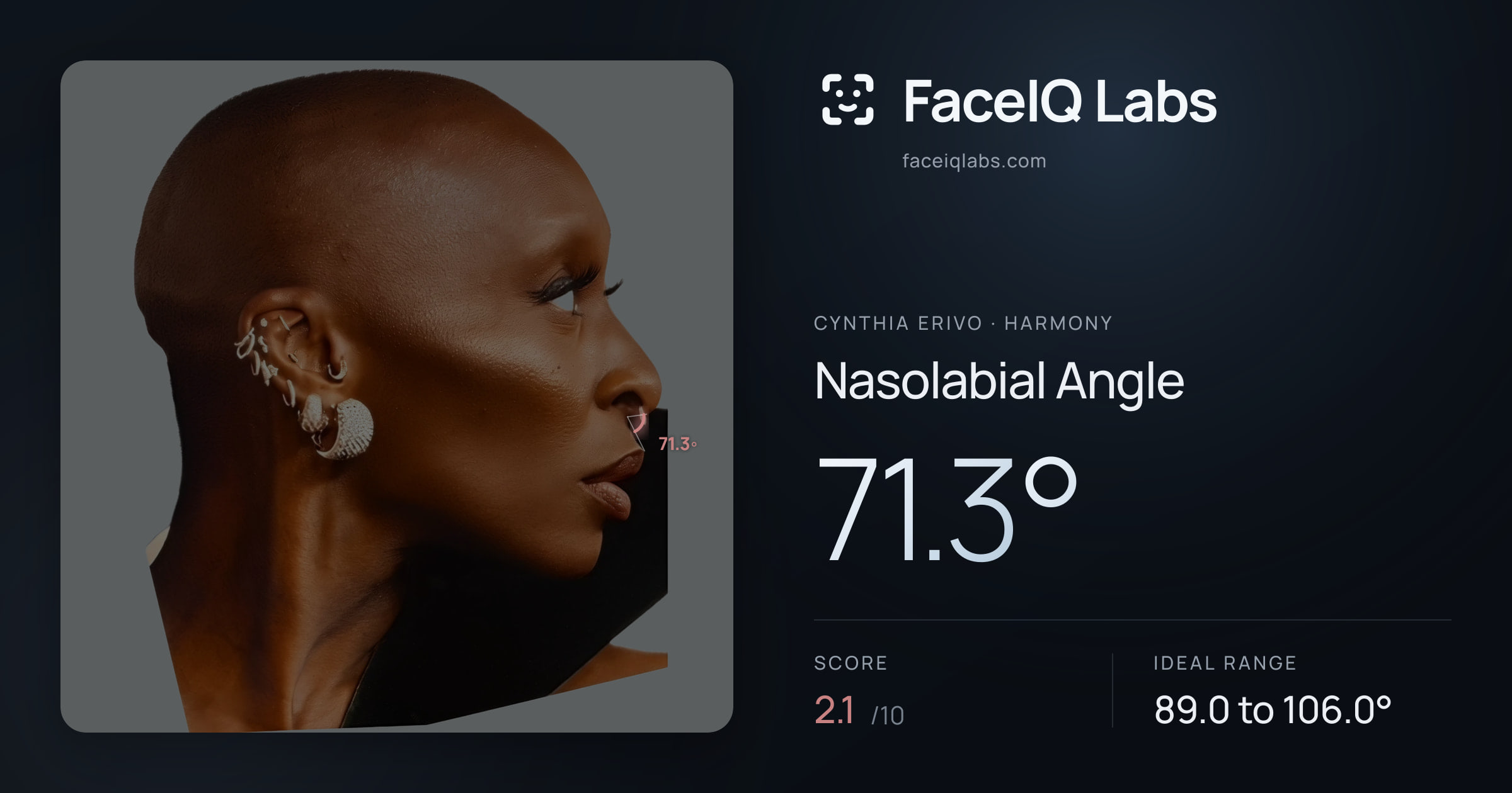 Cynthia Erivo Nasolabial Angle: 71.3°, drawn on the photo
