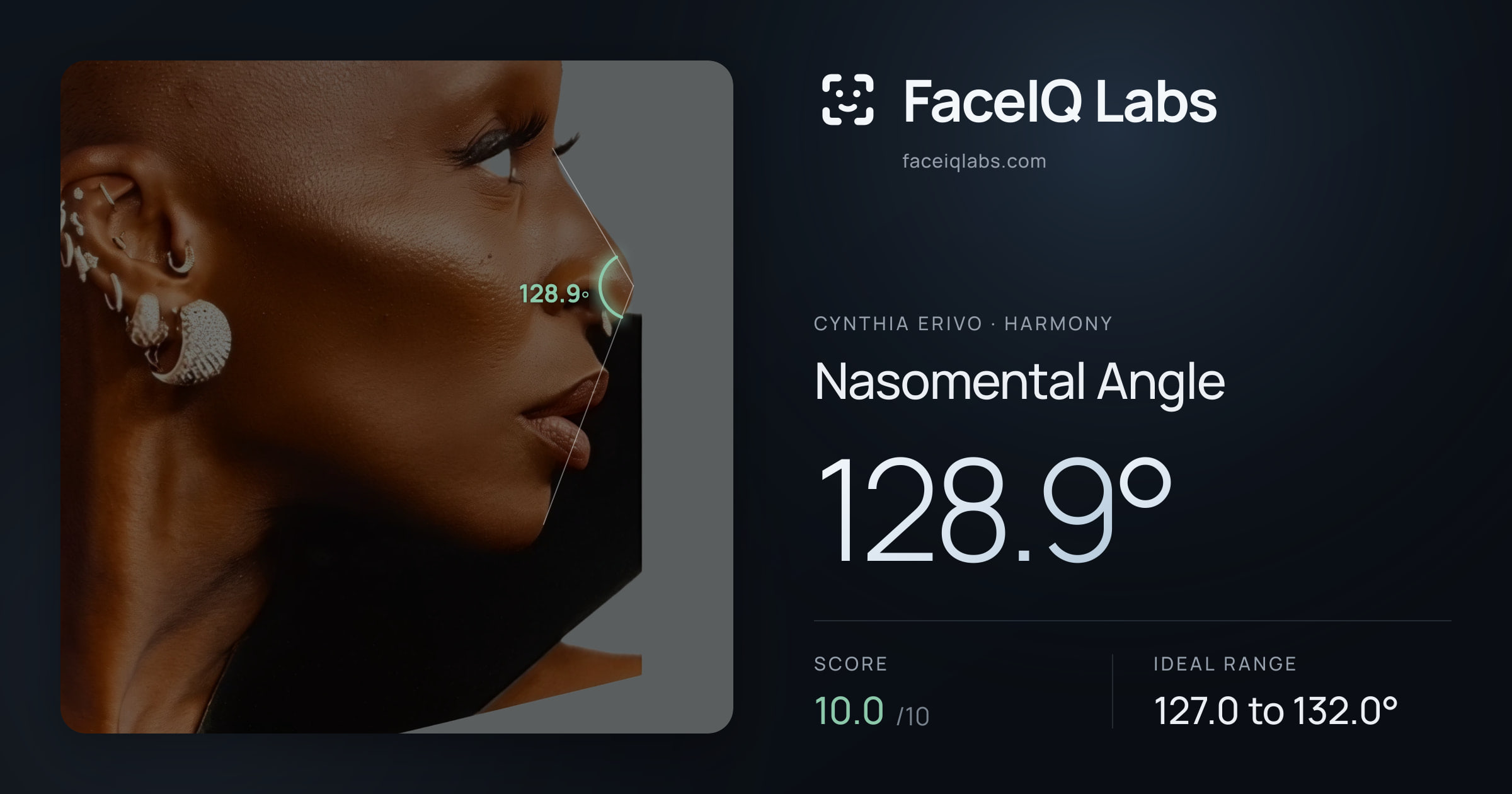 Cynthia Erivo Nasomental Angle: 128.9°, drawn on the photo