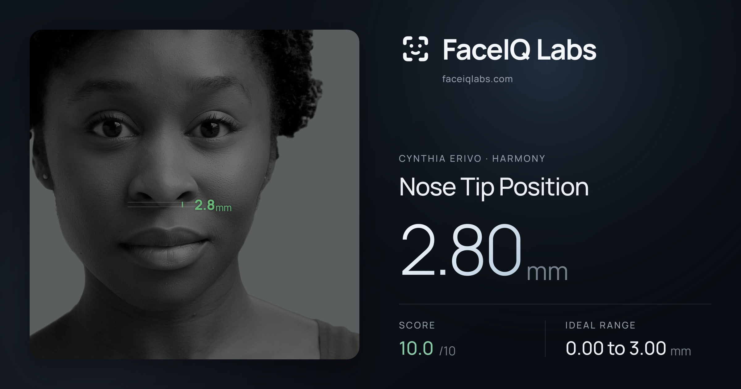 Cynthia Erivo Nose Tip Position: 2.80mm, drawn on the photo
