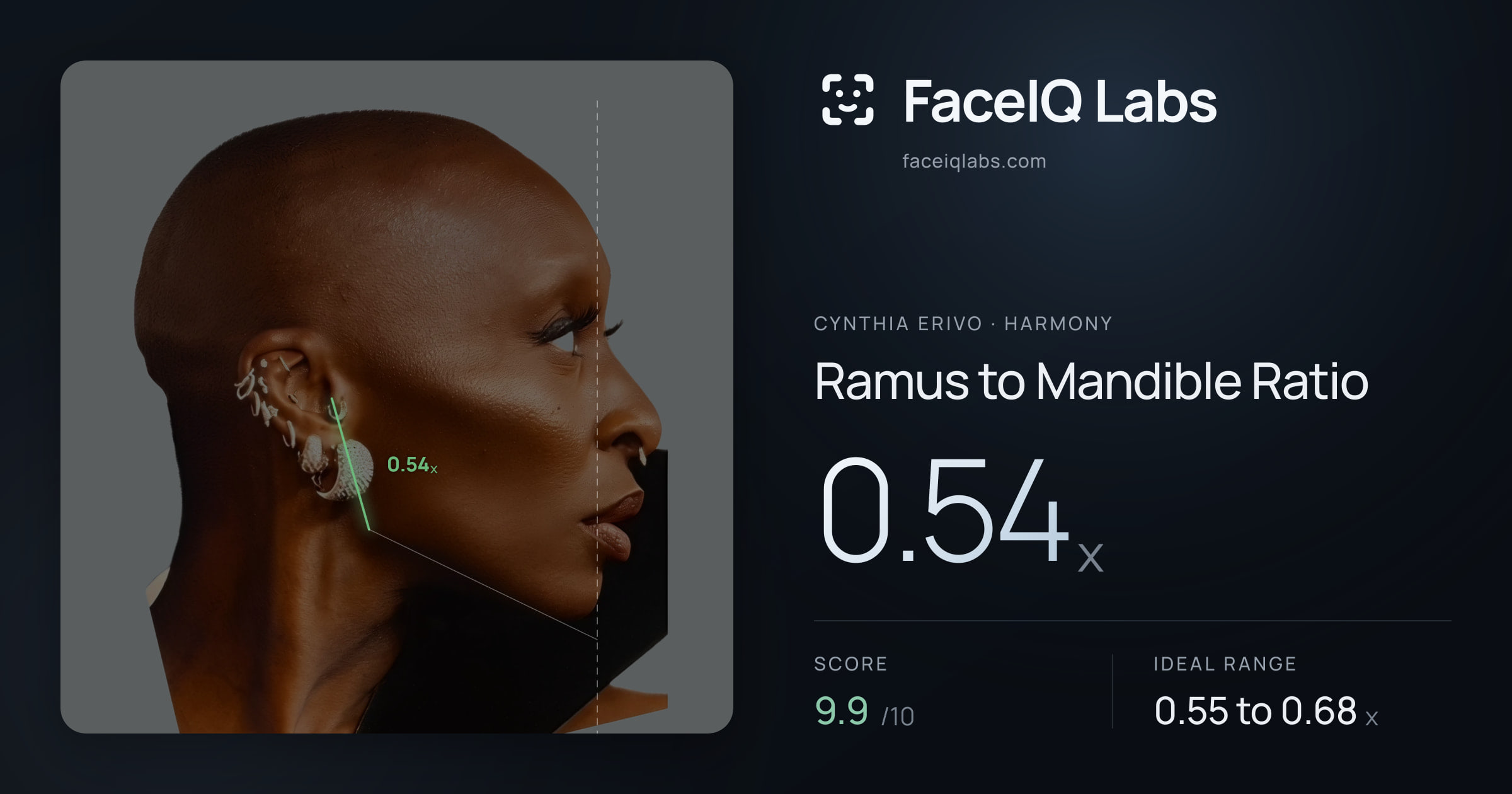 Cynthia Erivo Ramus to Mandible Ratio: 0.54x, drawn on the photo