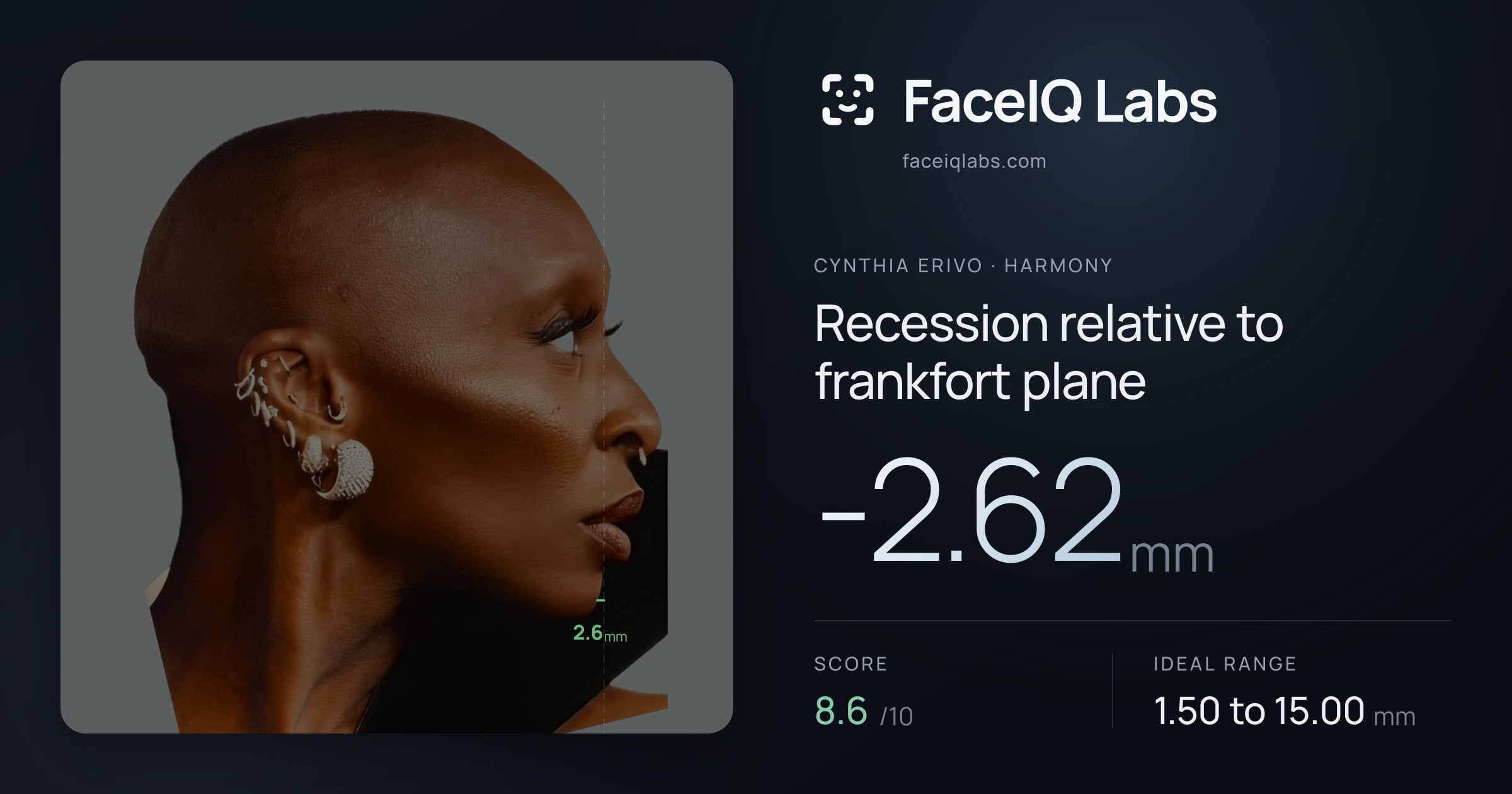 Cynthia Erivo Recession relative to frankfort plane: -2.62mm, drawn on the photo