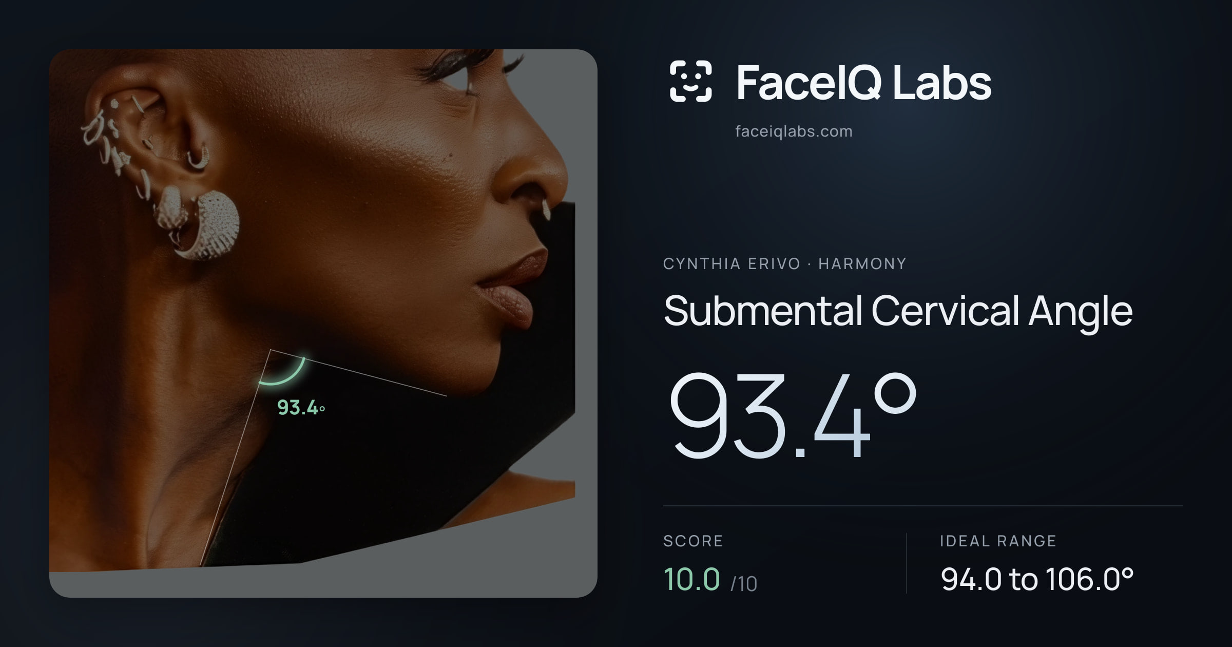 Cynthia Erivo Submental Cervical Angle: 93.4°, drawn on the photo