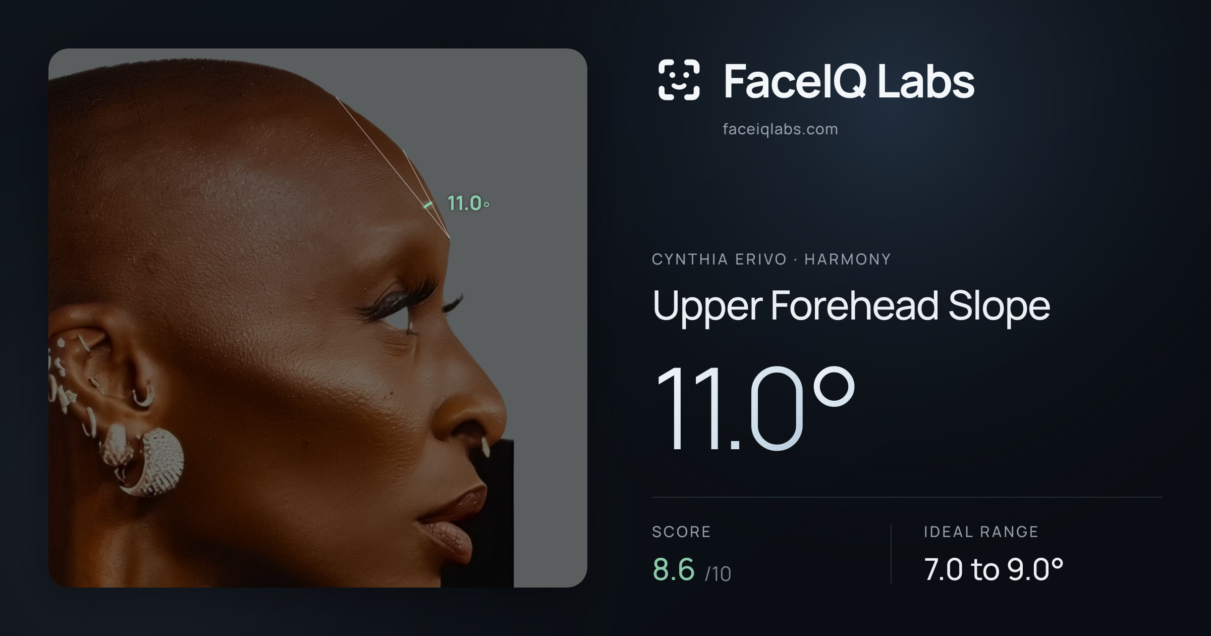 Cynthia Erivo Upper Forehead Slope: 11.0°, drawn on the photo