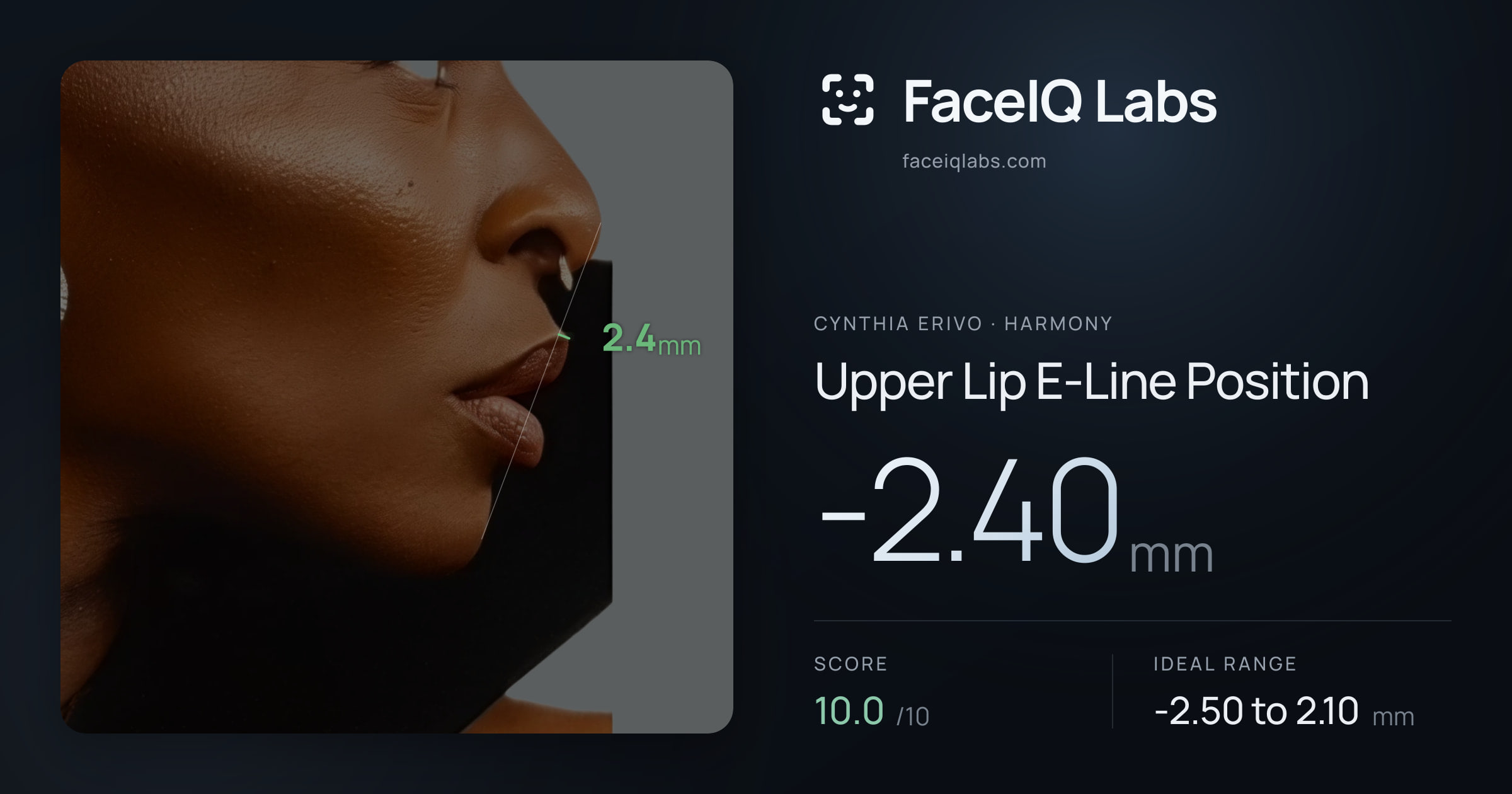 Cynthia Erivo Upper Lip E-Line Position: -2.40mm, drawn on the photo
