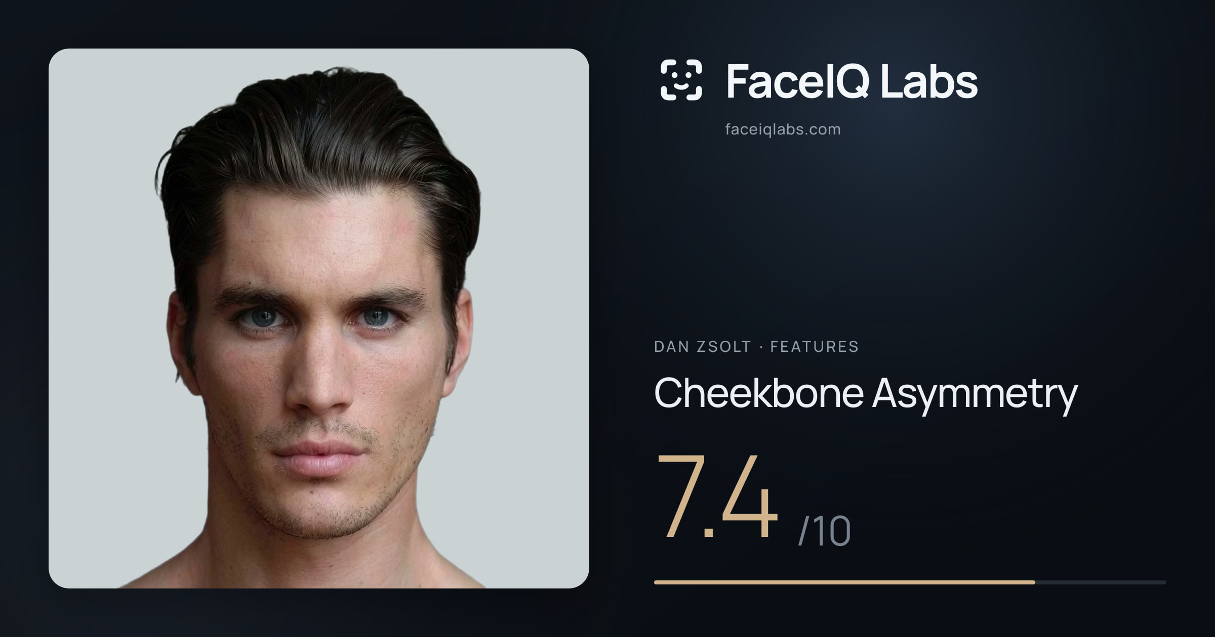 Dan Zsolt Cheekbone Asymmetry: 7.4/10, drawn on the photo
