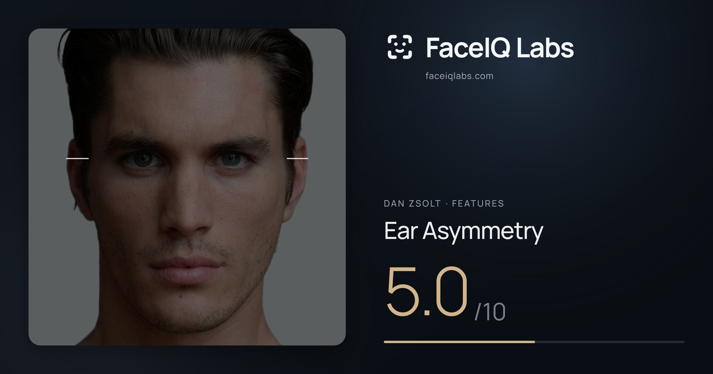 Dan Zsolt Ear Asymmetry: 5.0/10, drawn on the photo