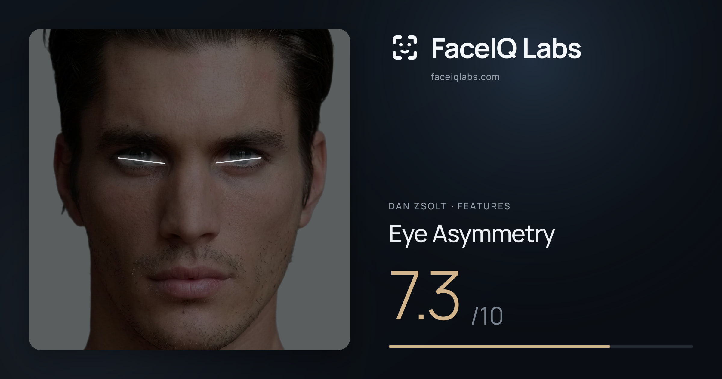 Dan Zsolt Eye Asymmetry: 7.3/10, drawn on the photo