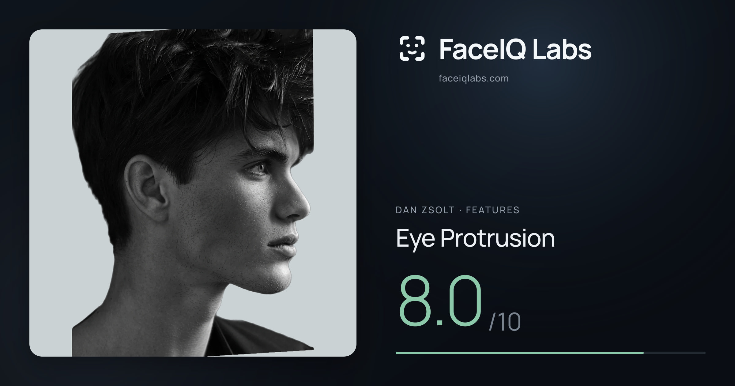 Dan Zsolt Eye Protrusion: 8.0/10, drawn on the photo
