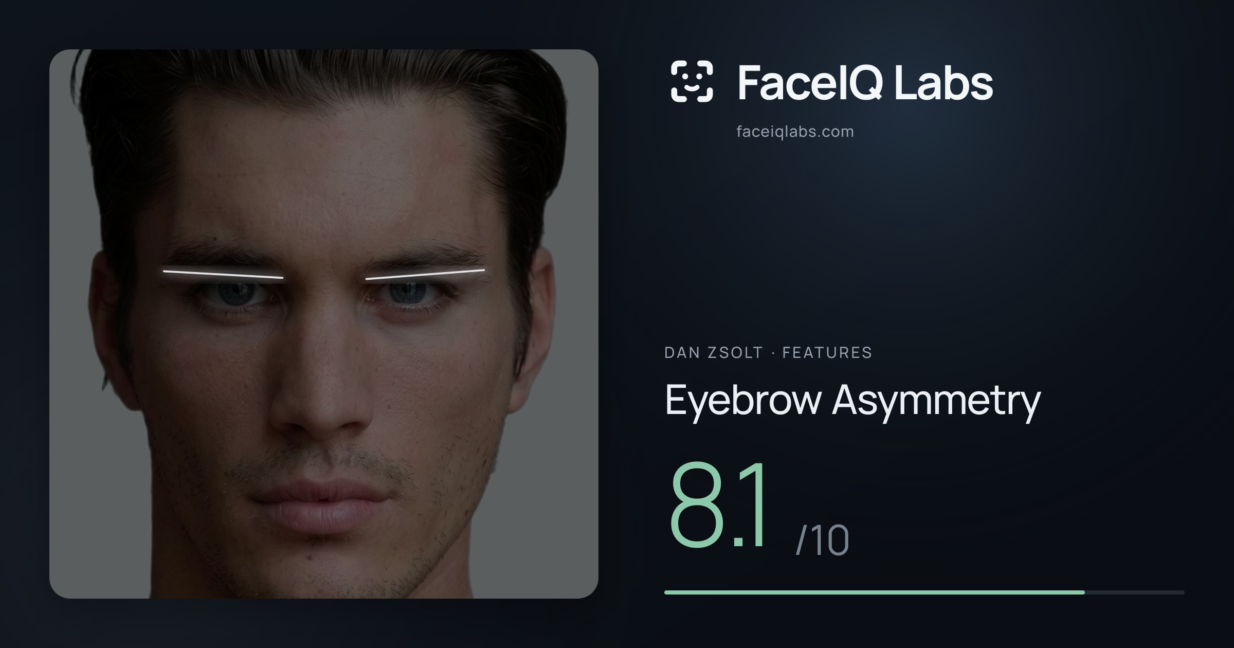 Dan Zsolt Eyebrow Asymmetry: 8.1/10, drawn on the photo