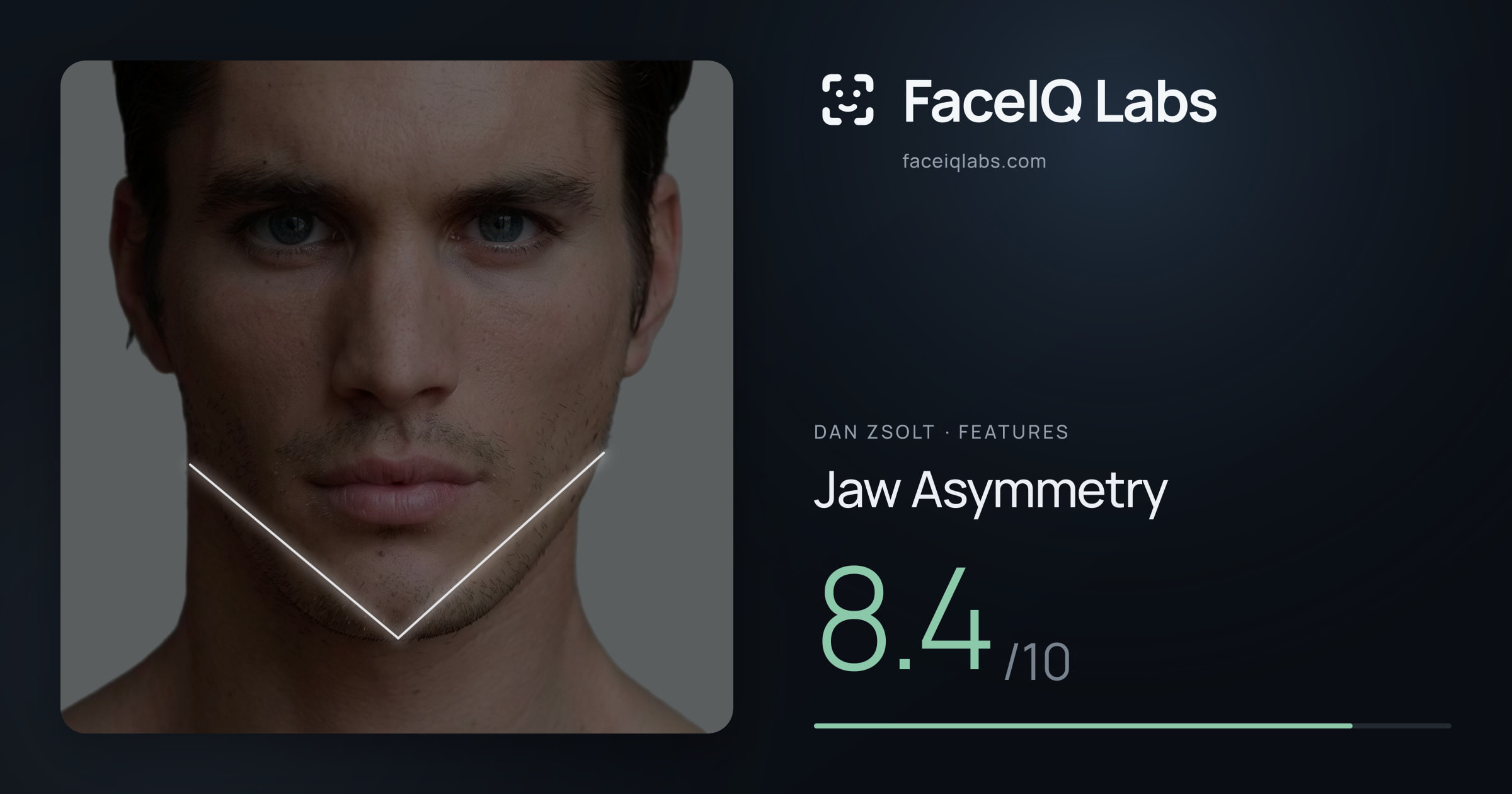 Dan Zsolt Jaw Asymmetry: 8.4/10, drawn on the photo