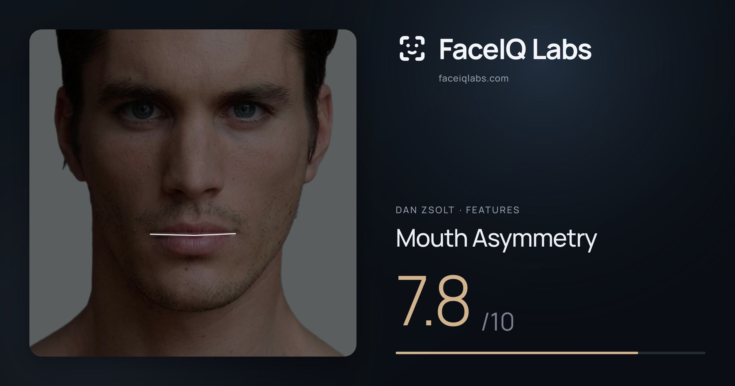 Dan Zsolt Mouth Asymmetry: 7.8/10, drawn on the photo