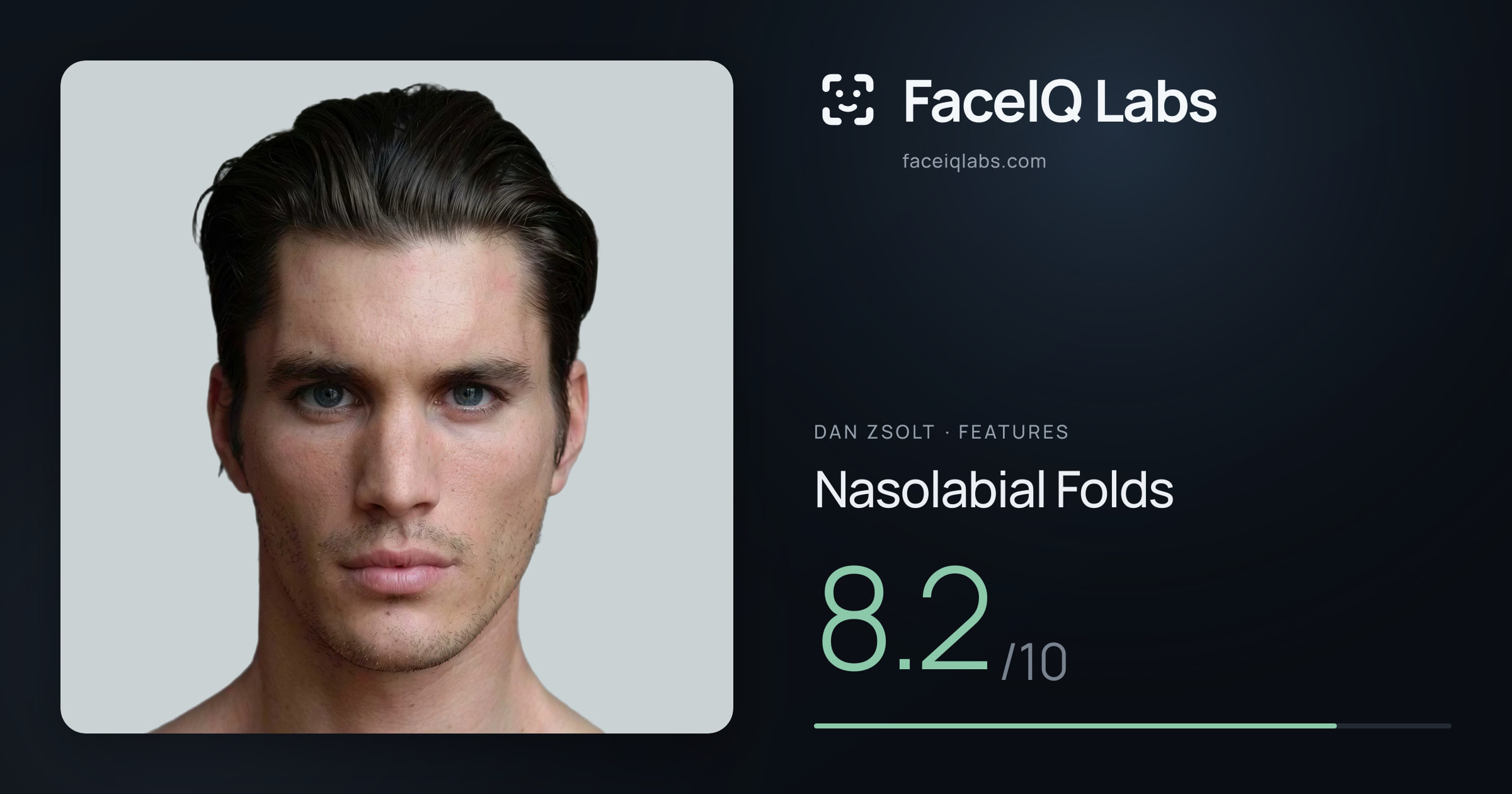 Dan Zsolt Nasolabial Folds: 8.2/10, drawn on the photo