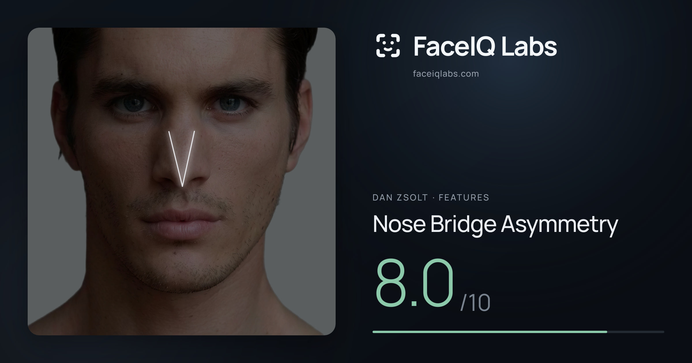 Dan Zsolt Nose Bridge Asymmetry: 8.0/10, drawn on the photo