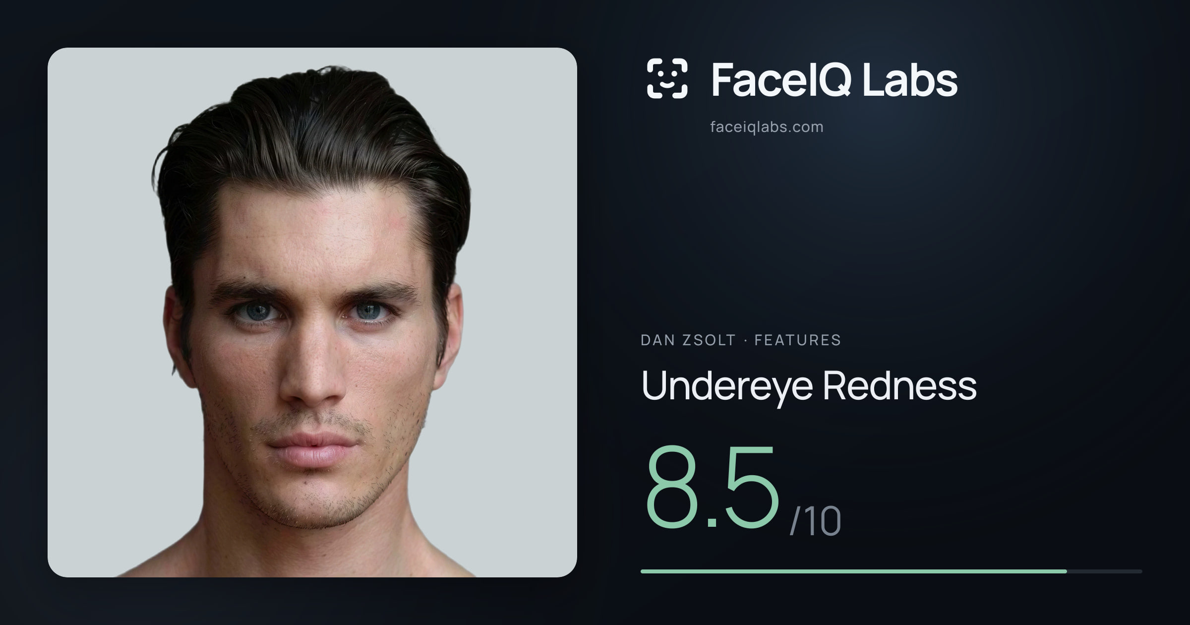 Dan Zsolt Undereye Redness: 8.5/10, drawn on the photo
