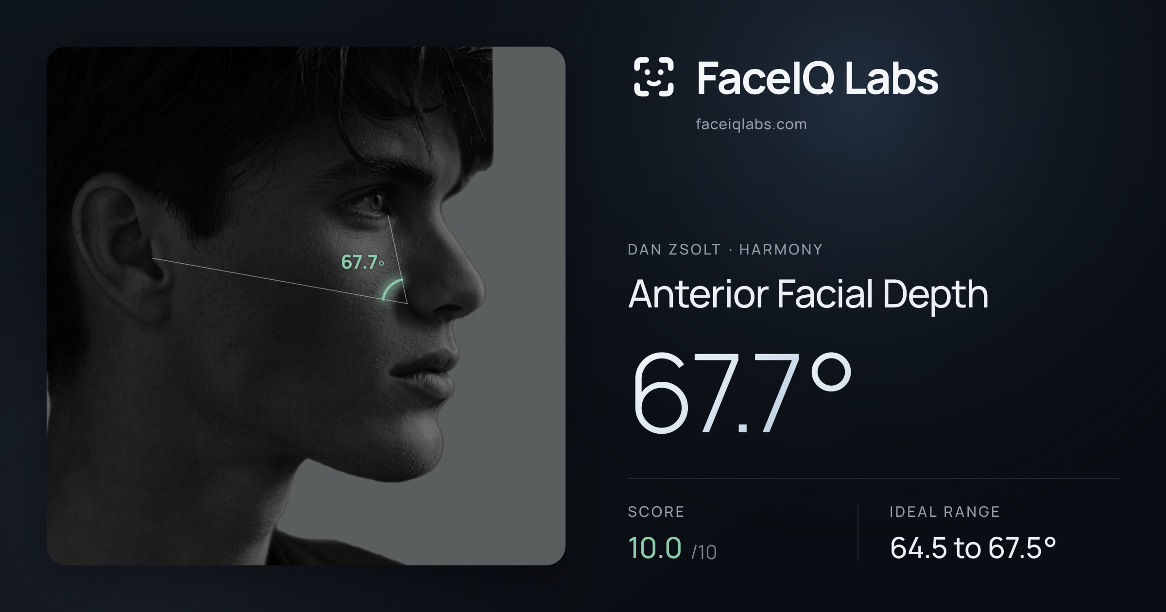 Dan Zsolt Anterior Facial Depth: 67.7°, drawn on the photo