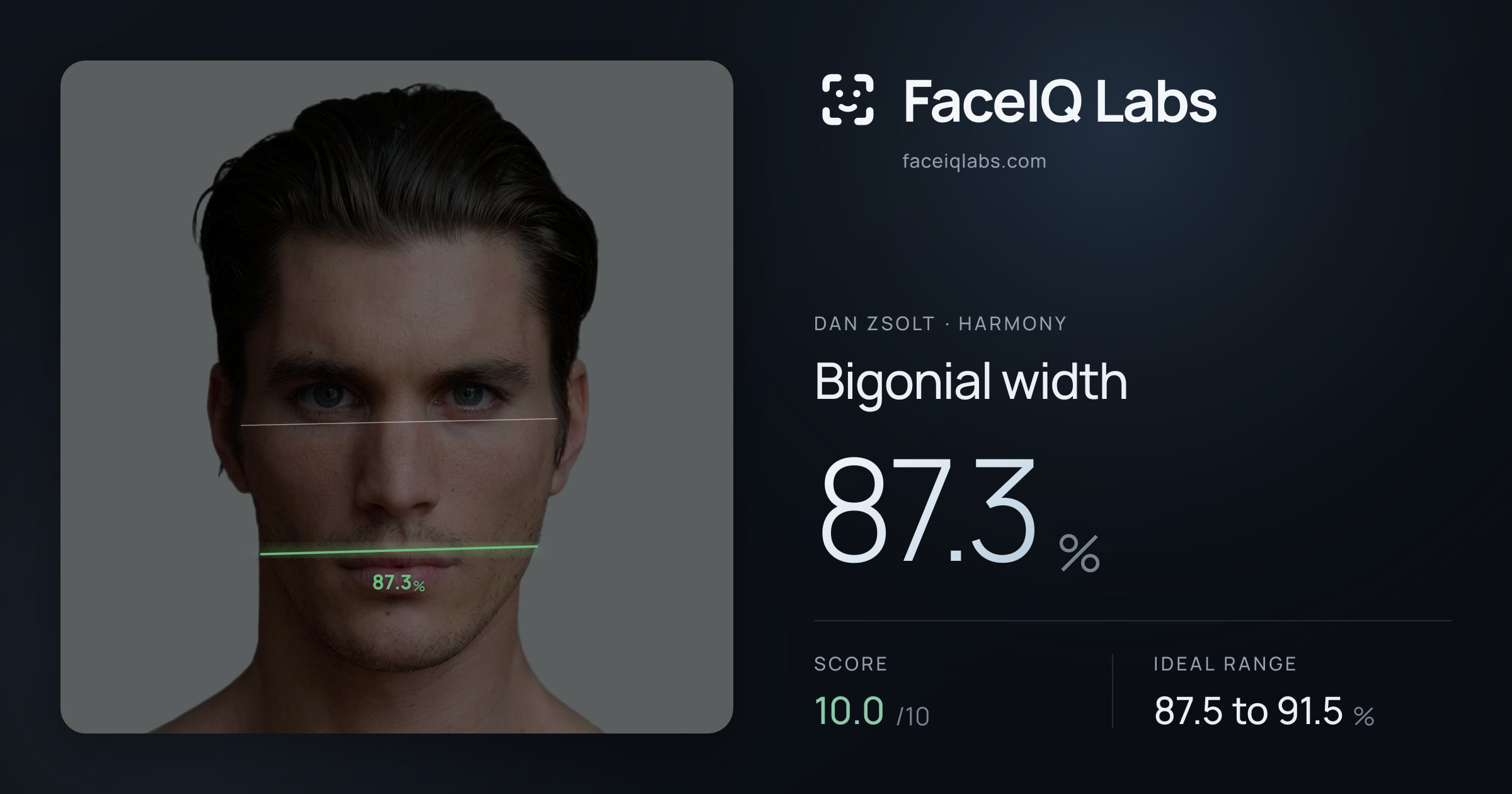 Dan Zsolt Bigonial width: 87.3%, drawn on the photo