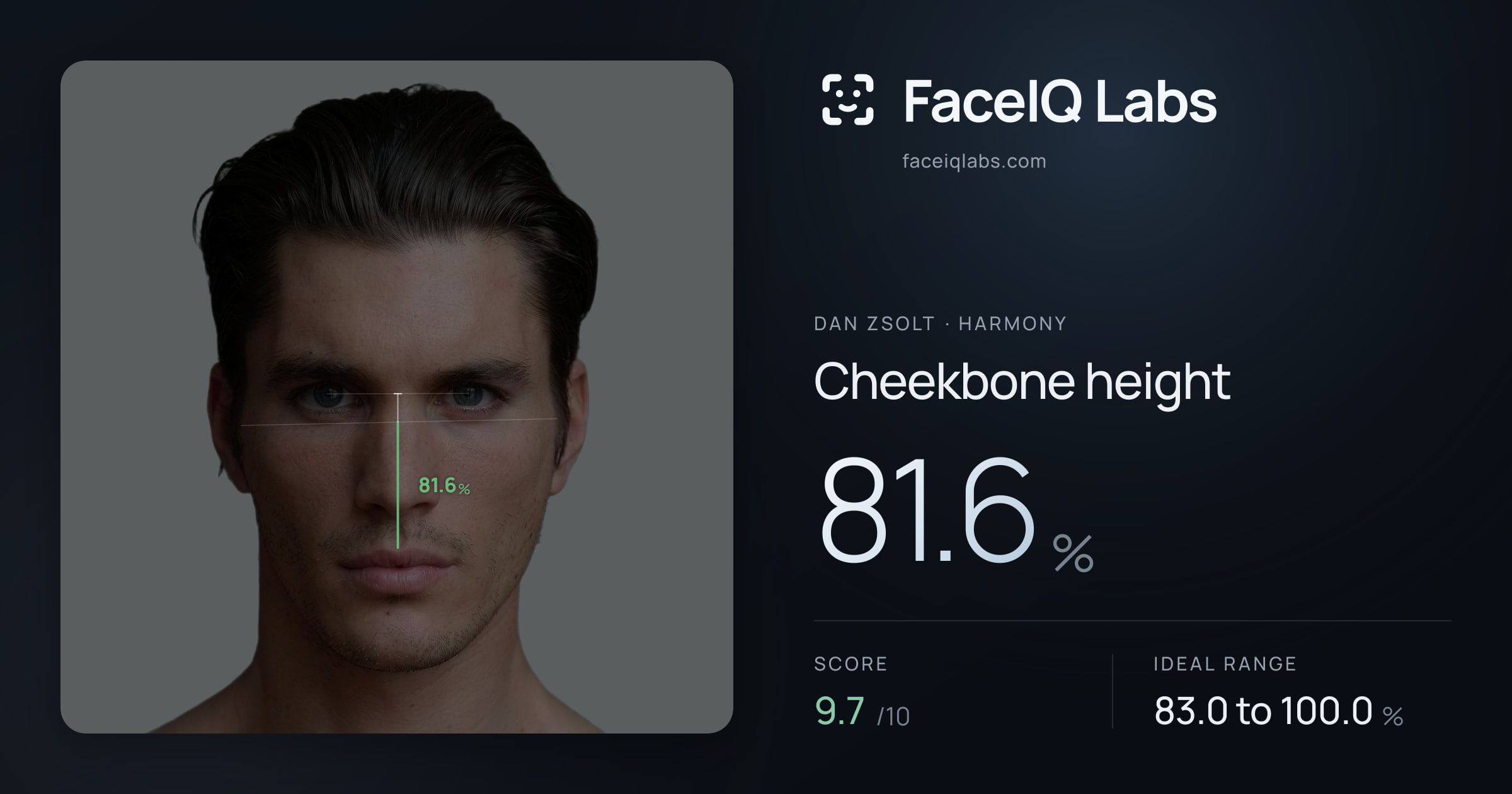 Dan Zsolt Cheekbone height: 81.6%, drawn on the photo