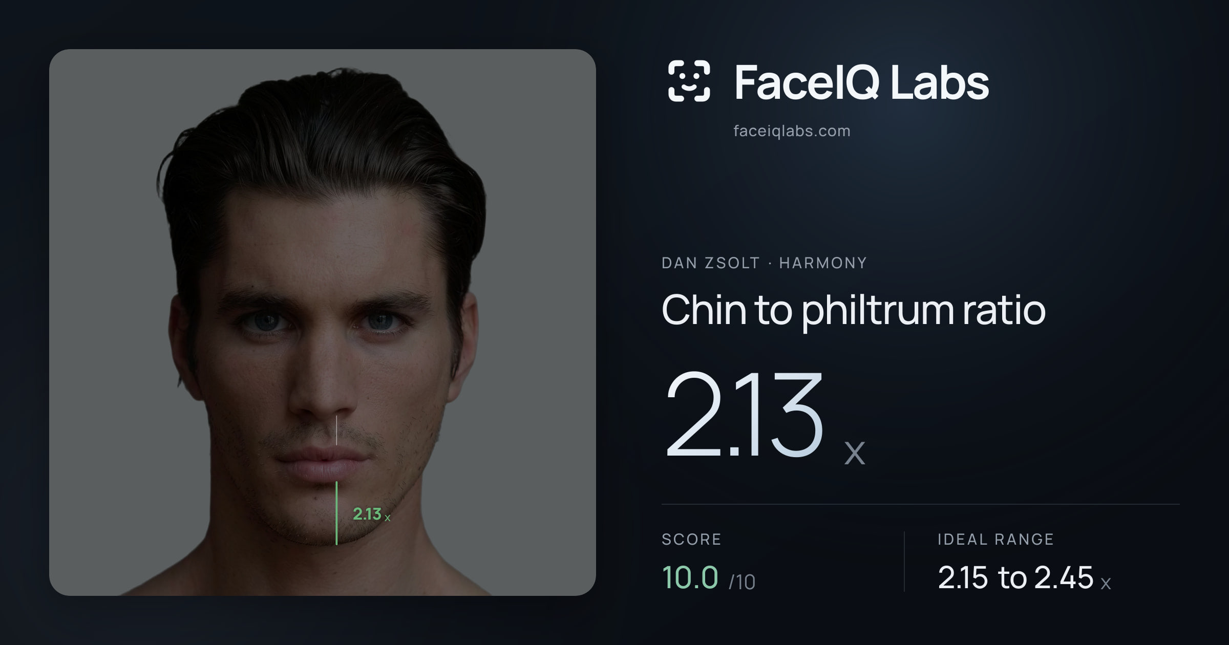 Dan Zsolt Chin to philtrum ratio: 2.13x, drawn on the photo