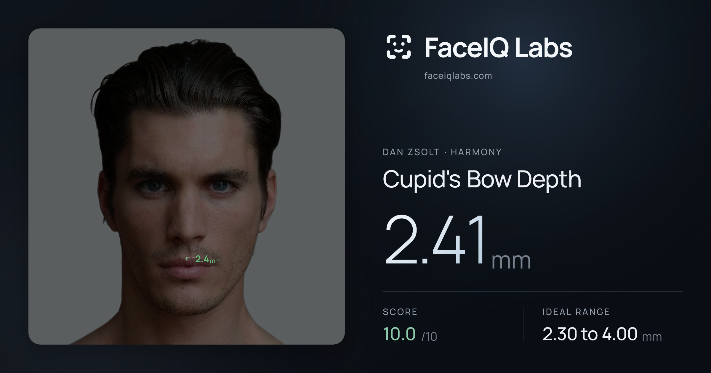 Dan Zsolt Cupid's Bow Depth: 2.41mm, drawn on the photo
